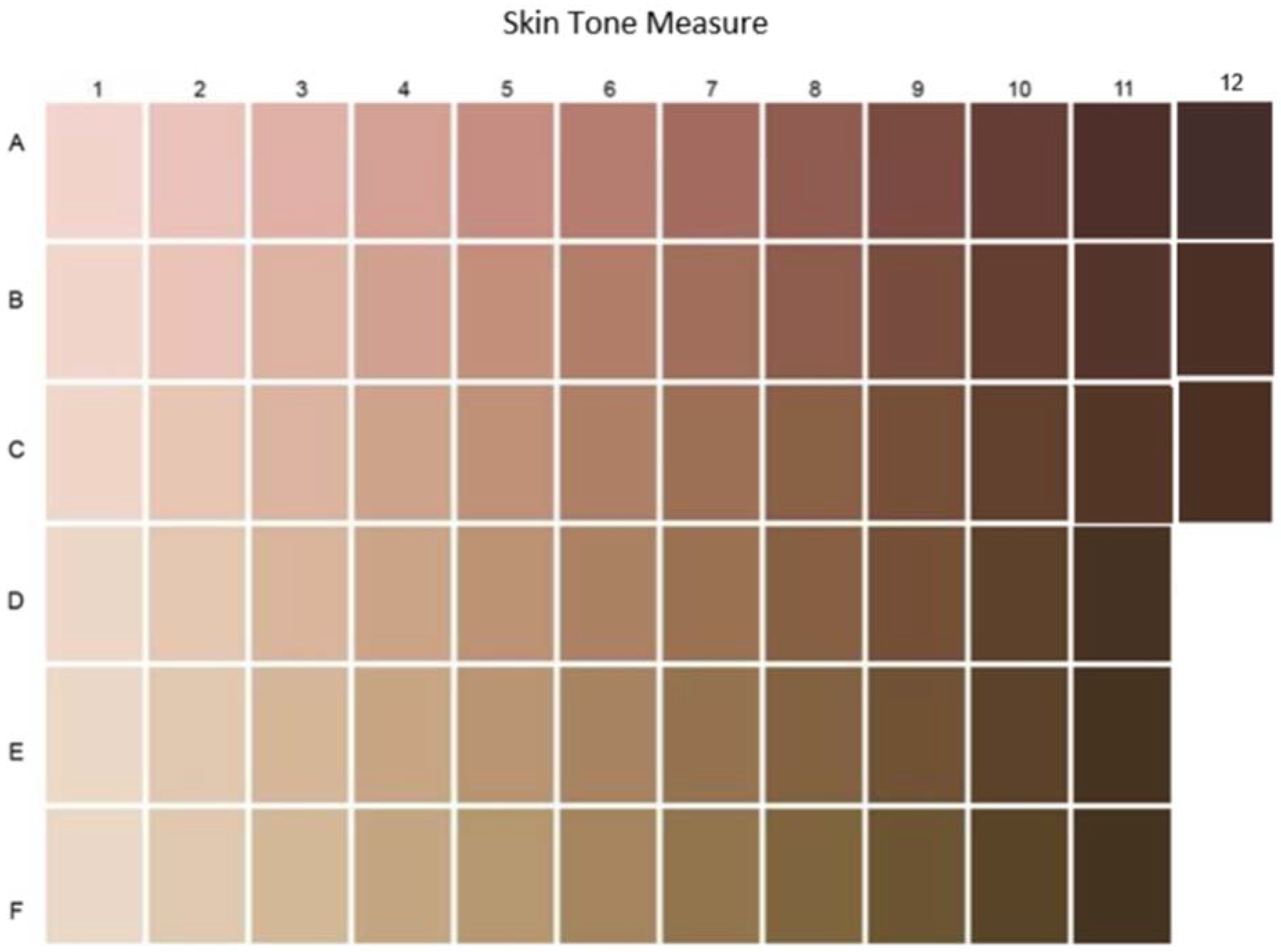 different skin tones of black people