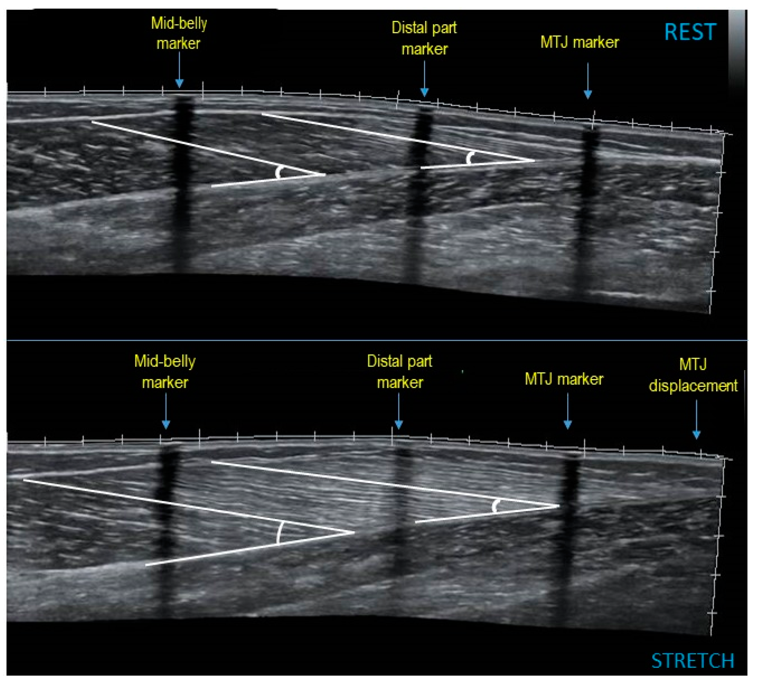 Sports 07 00039 g002 Sports 07 00039 g002
