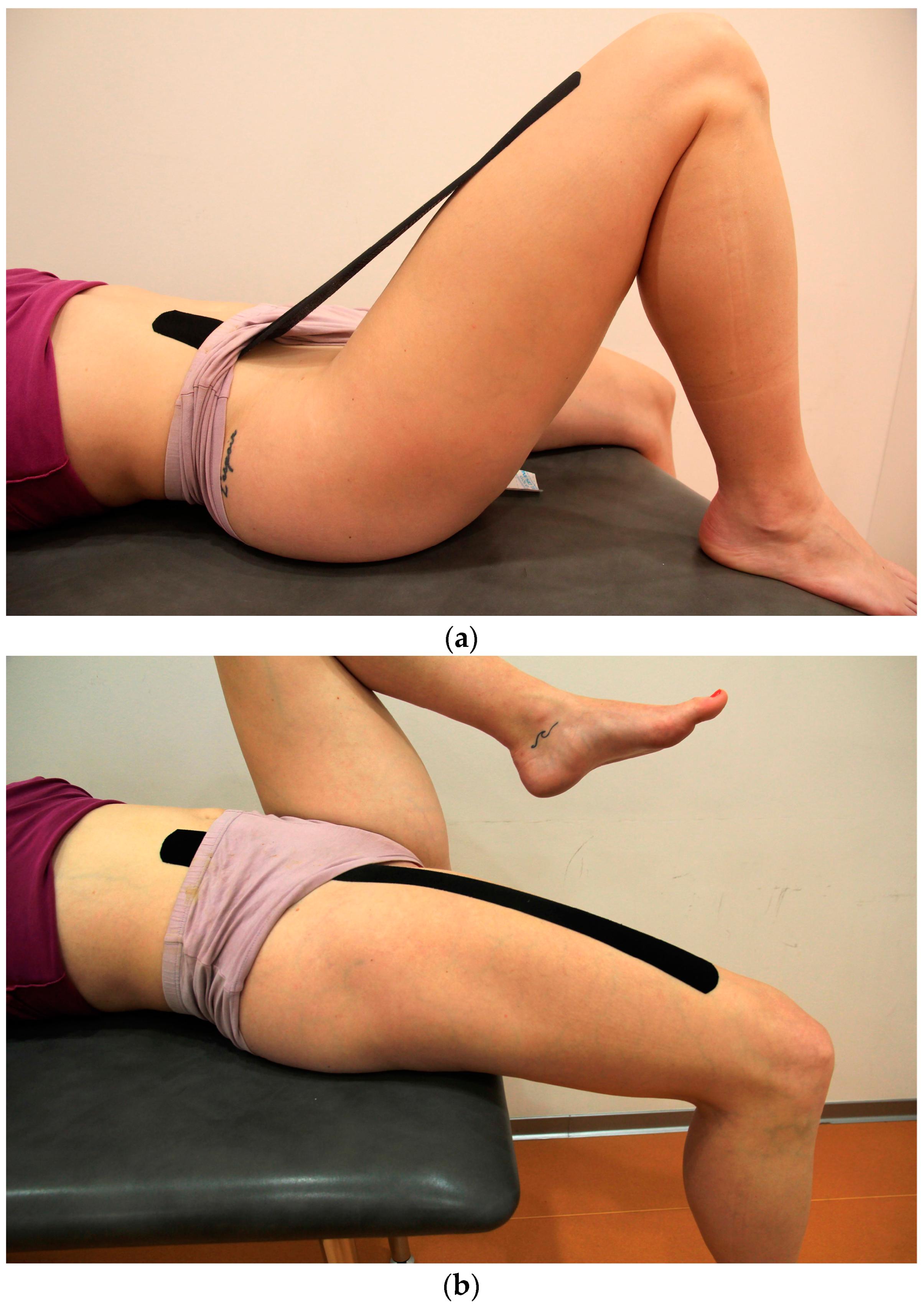 Sports | Free Full-Text | The Effects of Kinesio Taping&reg; on Muscle  Interplay within the Lumbo&ndash;Pelvic&ndash;Hip Complex: A Randomized  Placebo-Controlled Trial