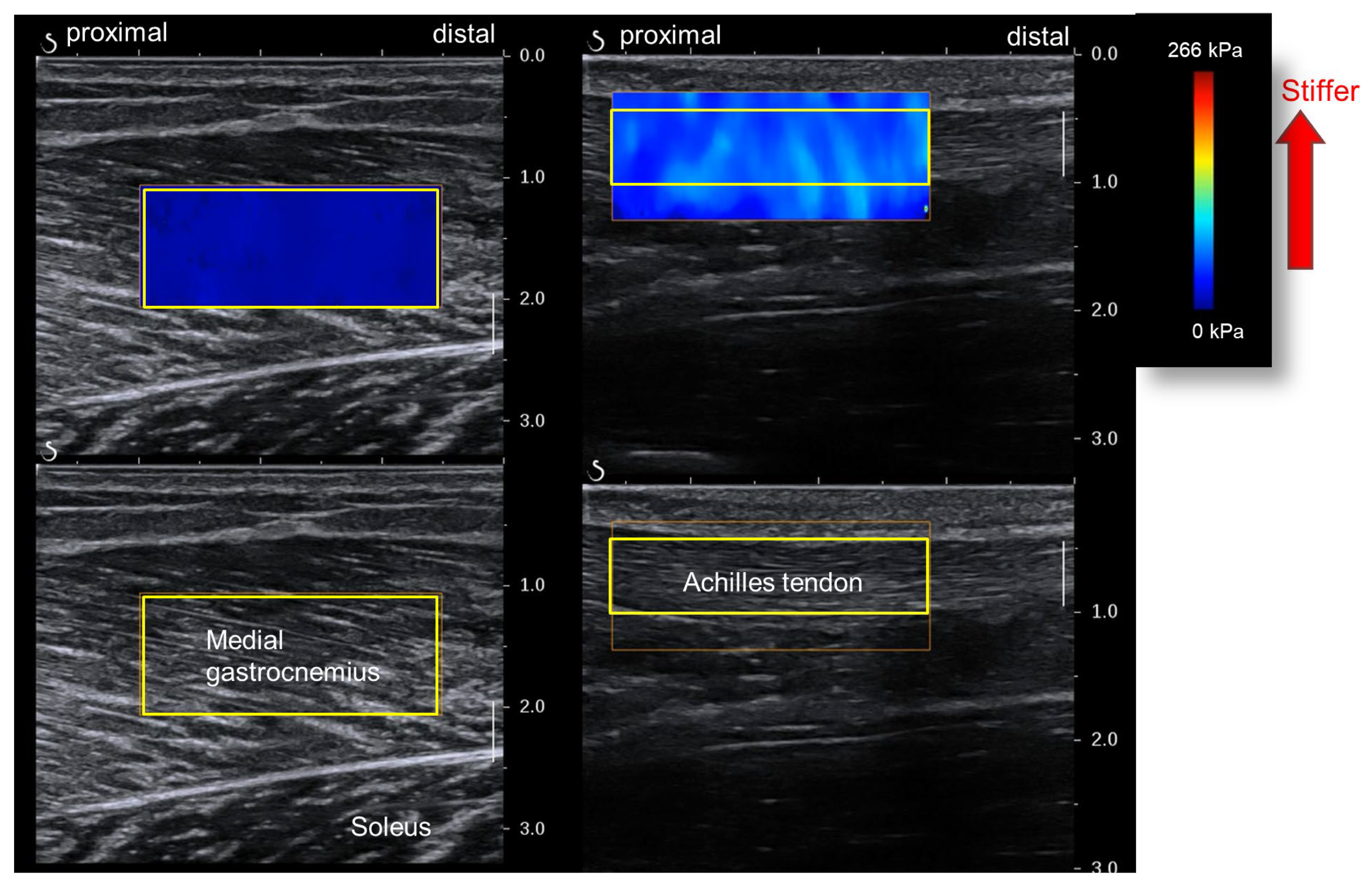 Sports 12 00150 g004