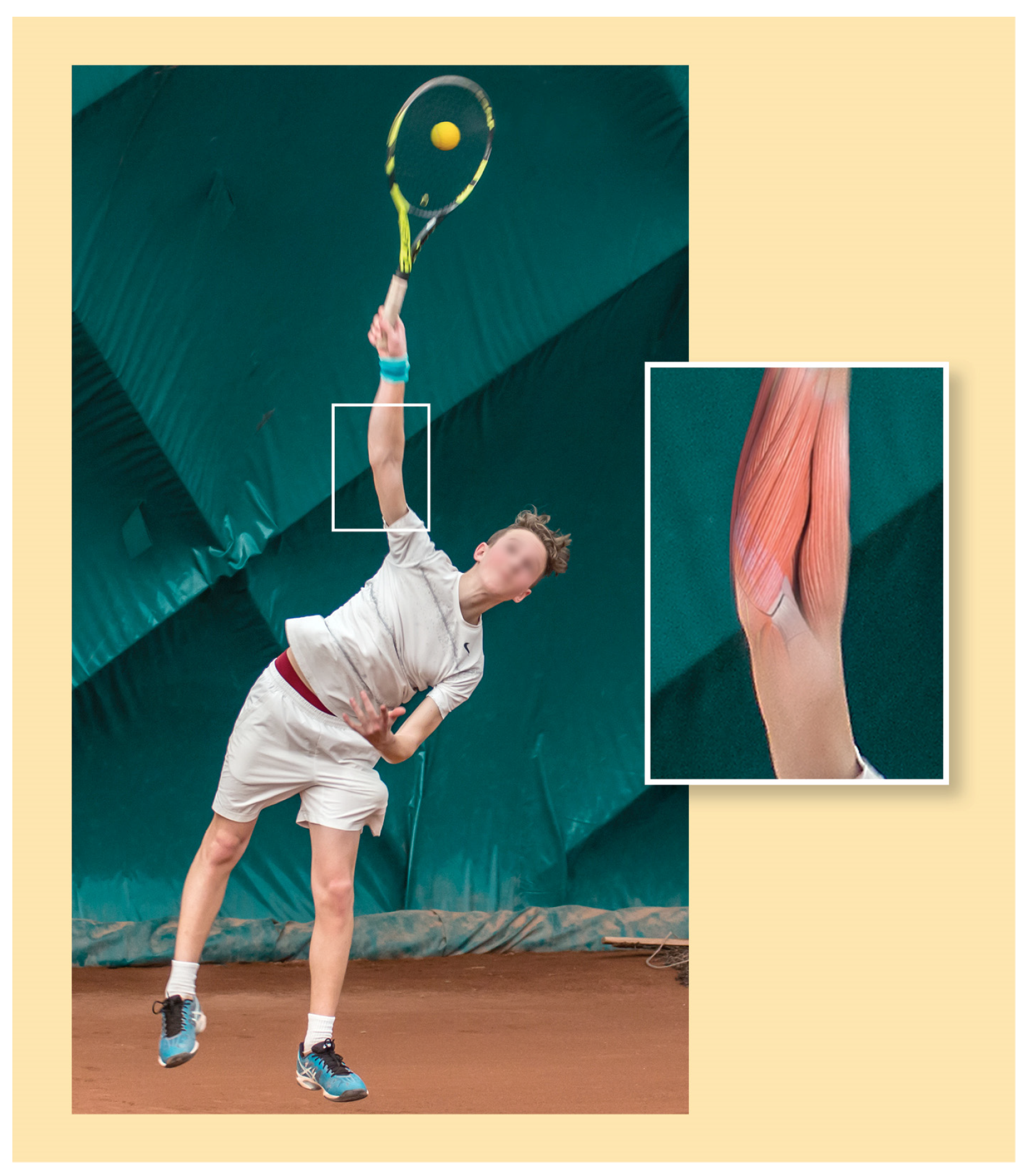 Sports 12 00292 g007 Sports 12 00292 g007