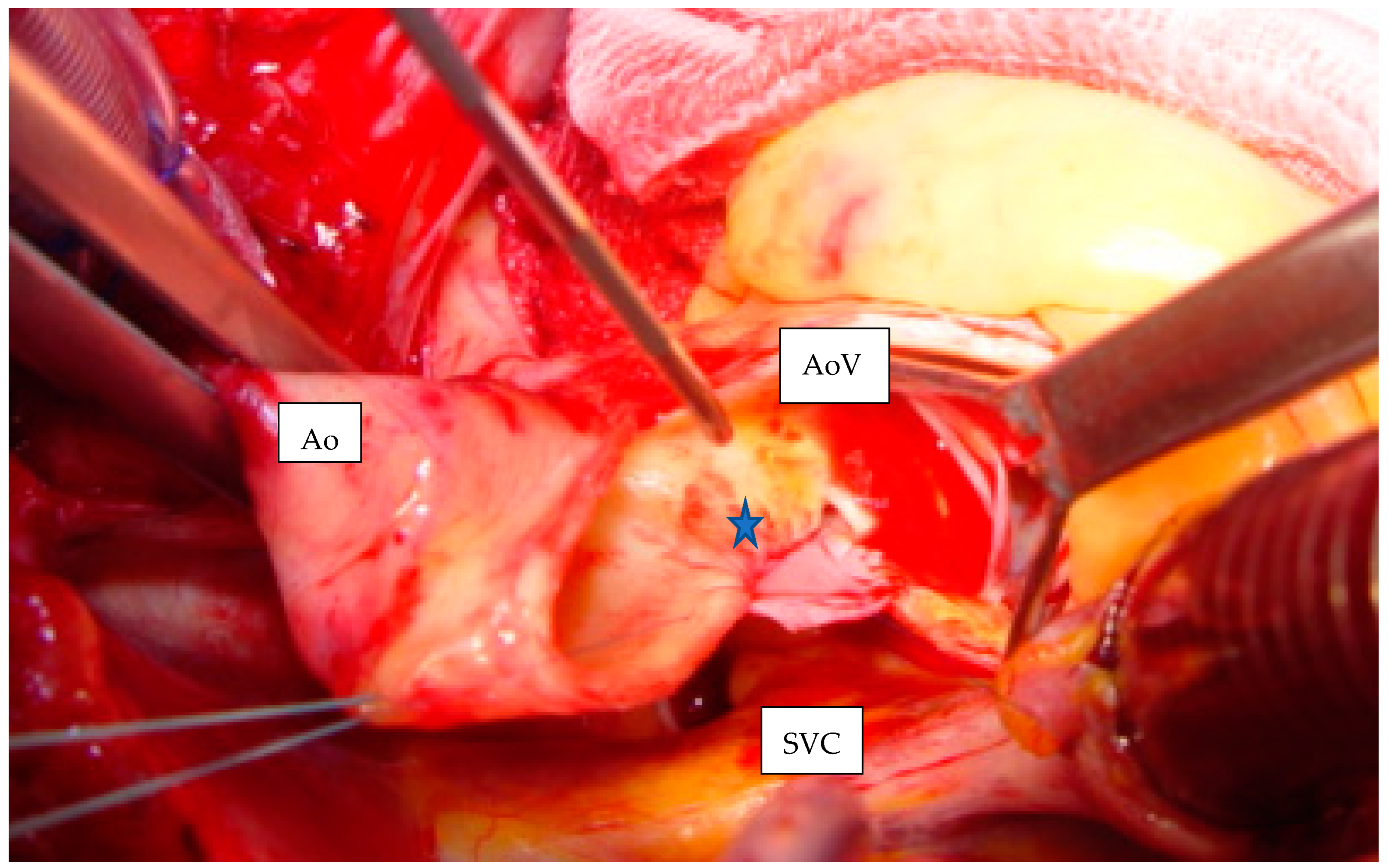 Std 11 00006 g003 Std 11 00006 g003