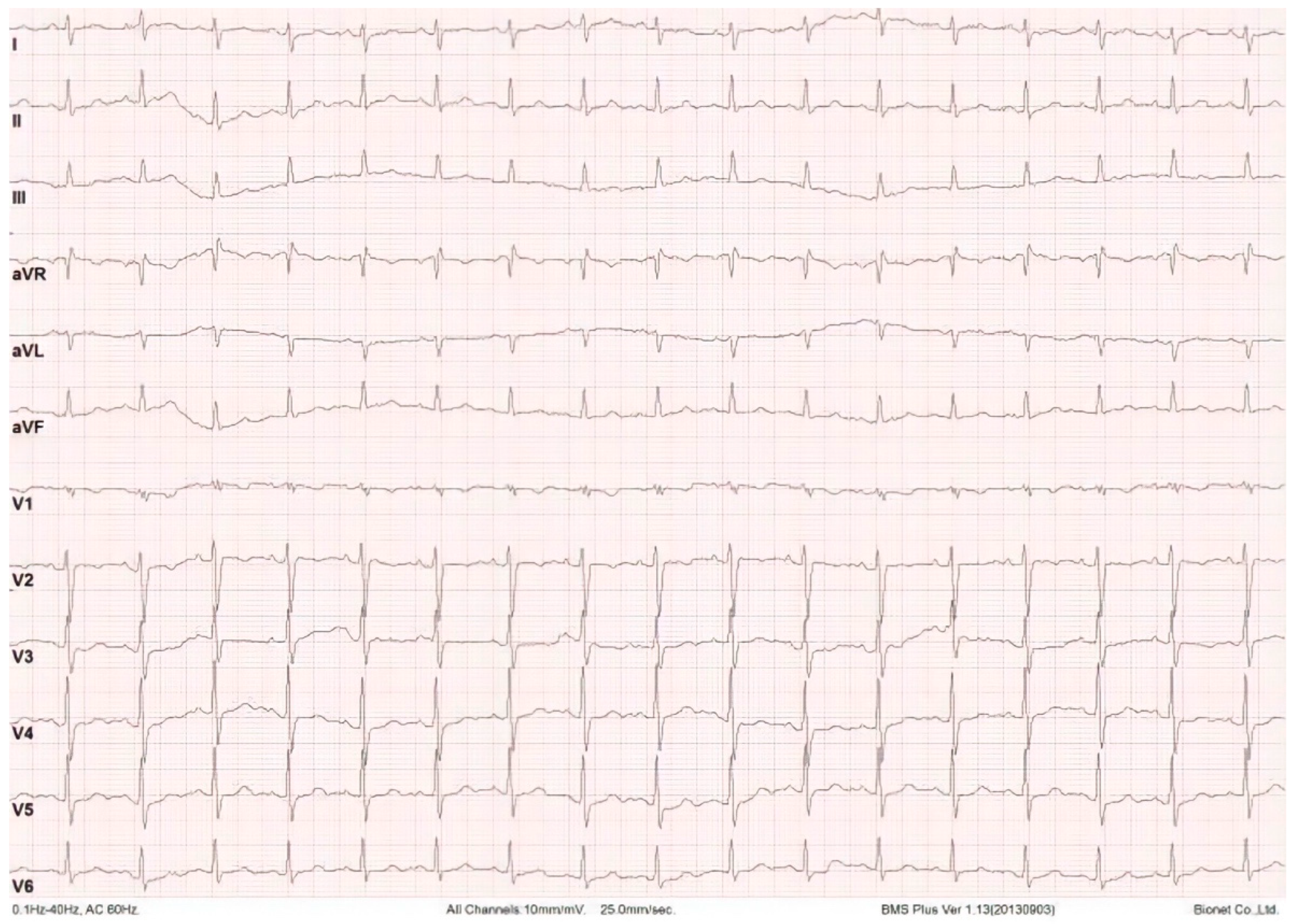 Std 11 00006 g004 Std 11 00006 g004