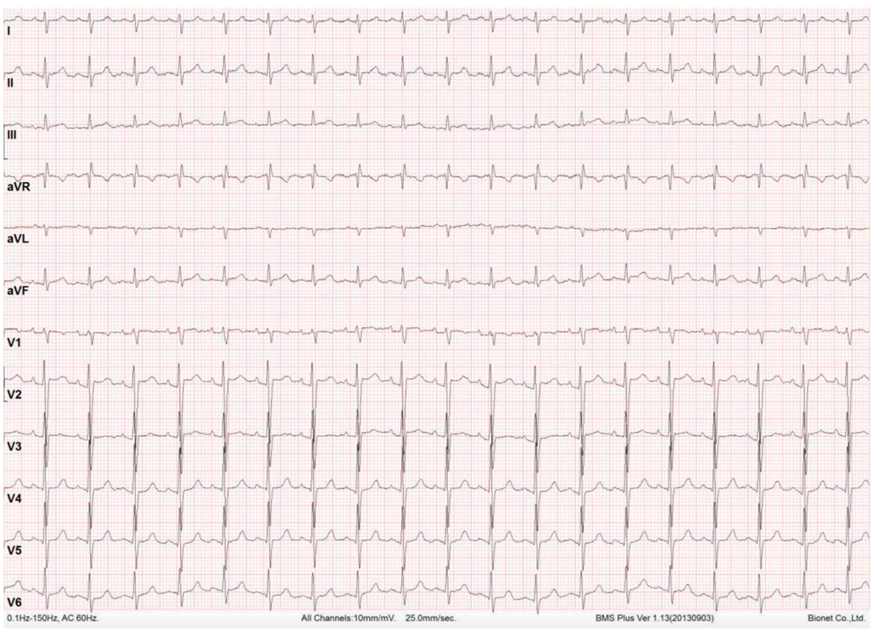 Std 11 00006 g005 Std 11 00006 g005