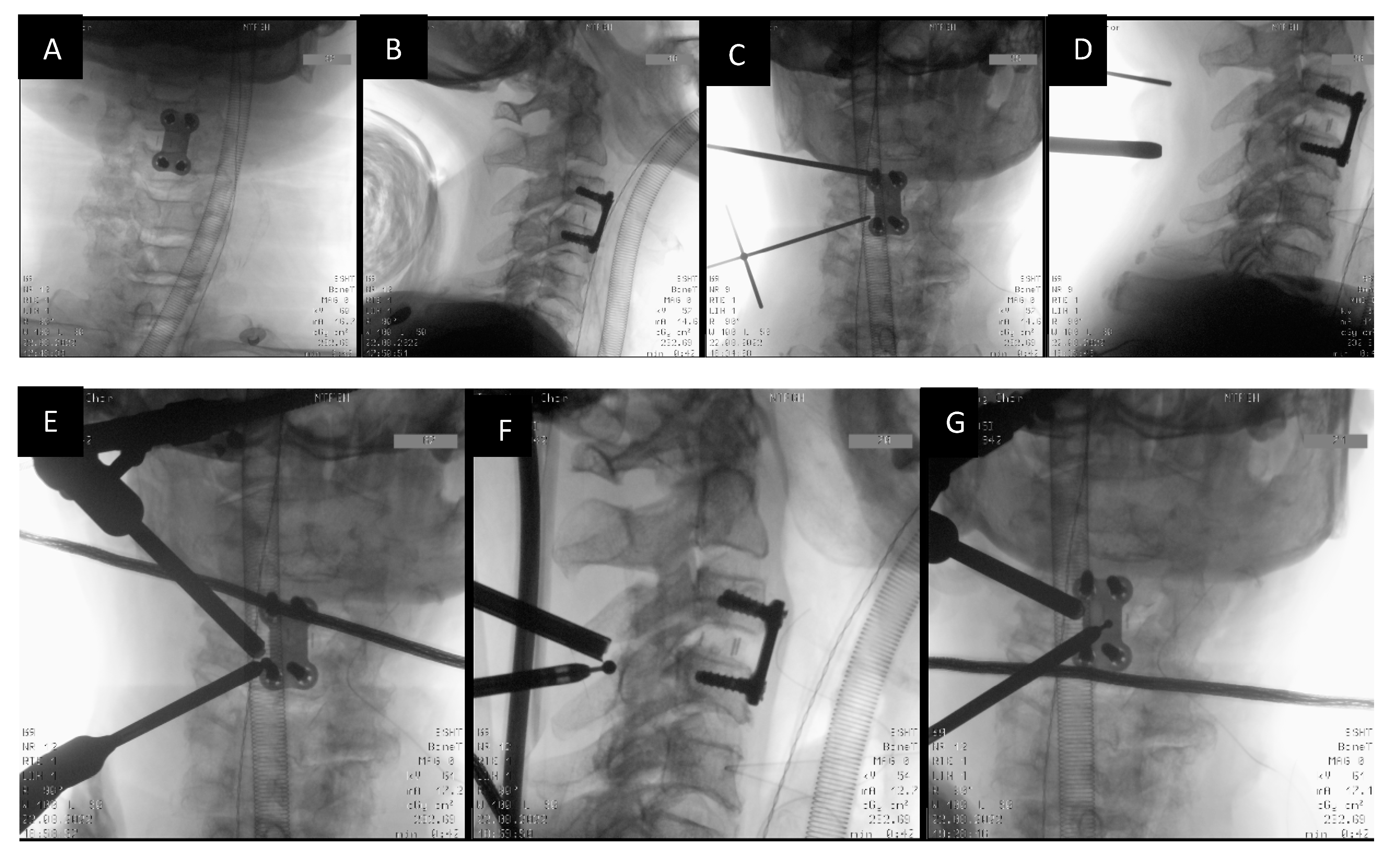 Std 12 00007 g003 Std 12 00007 g003