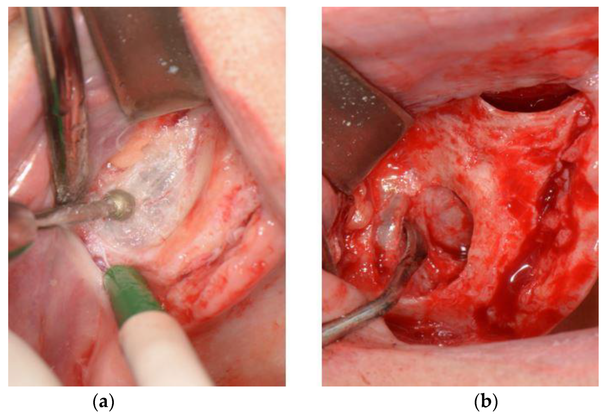 Surgeries 03 00033 g002 Surgeries 03 00033 g002