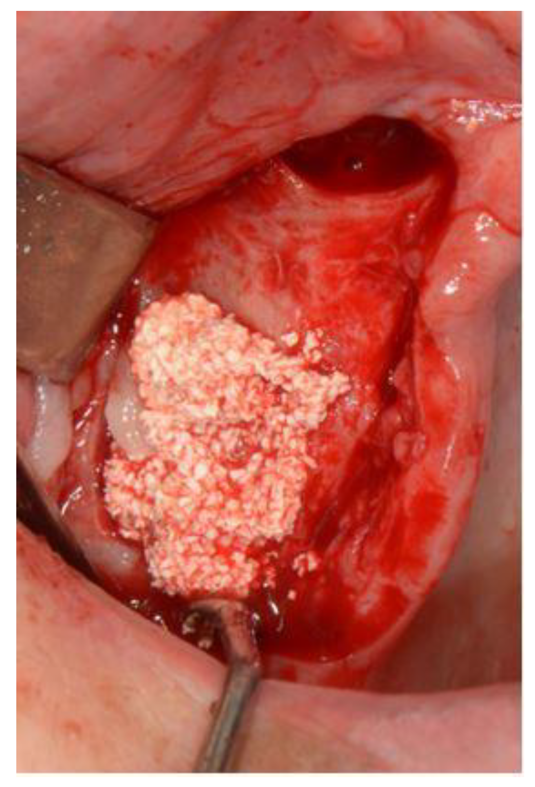 Surgeries 03 00033 g003 Surgeries 03 00033 g003