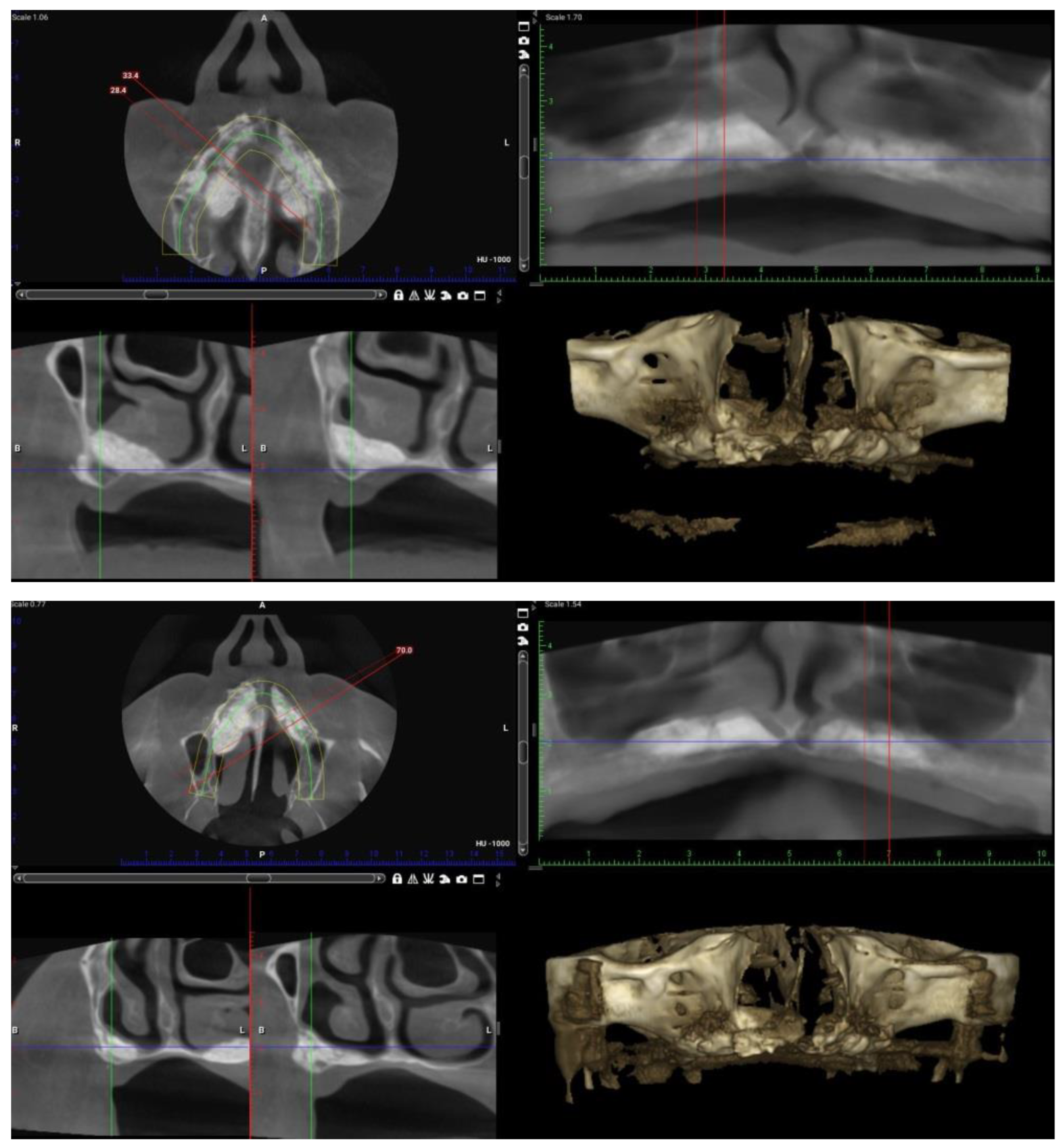 Surgeries 03 00033 g004 Surgeries 03 00033 g004