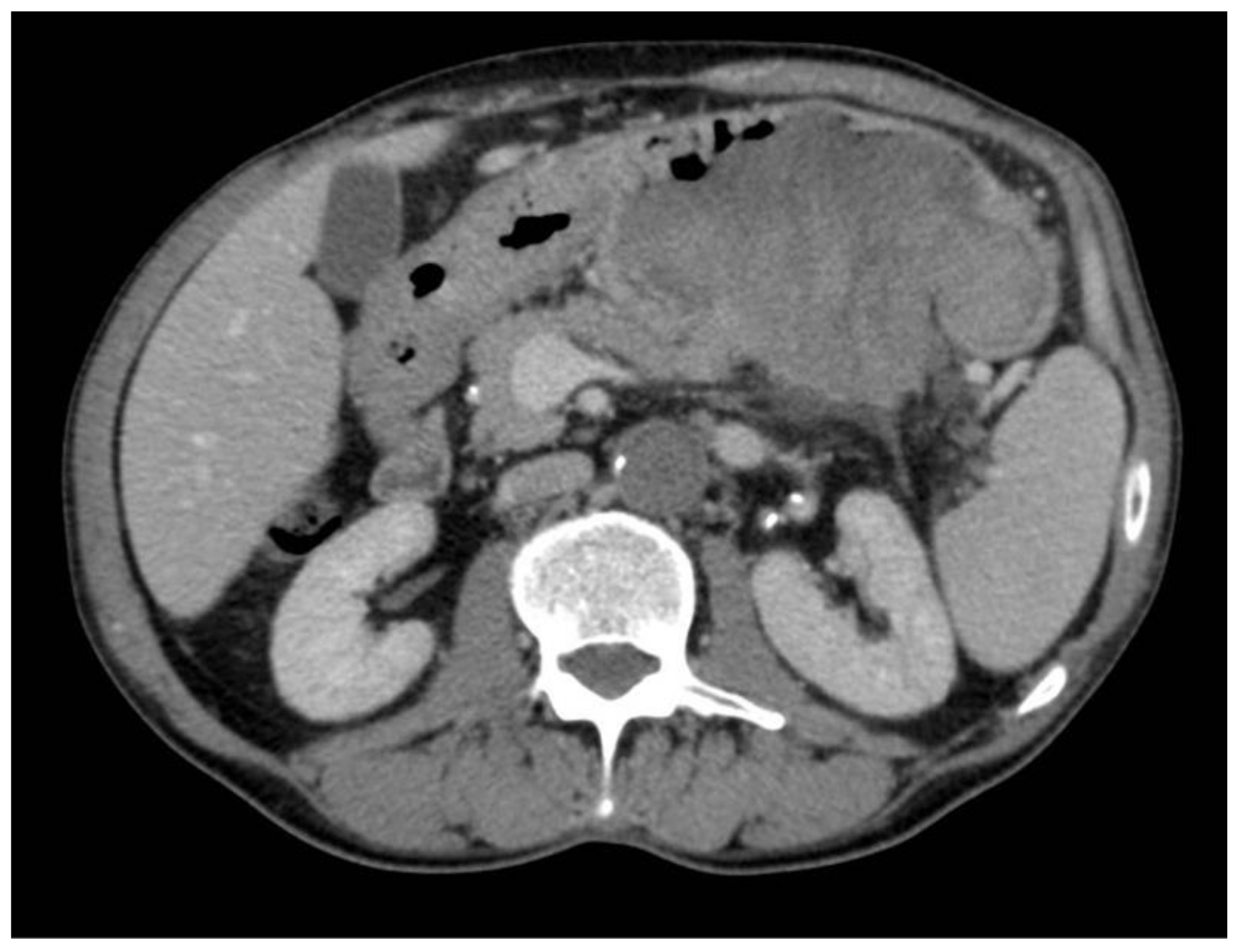 Surgeries 04 00009 g002