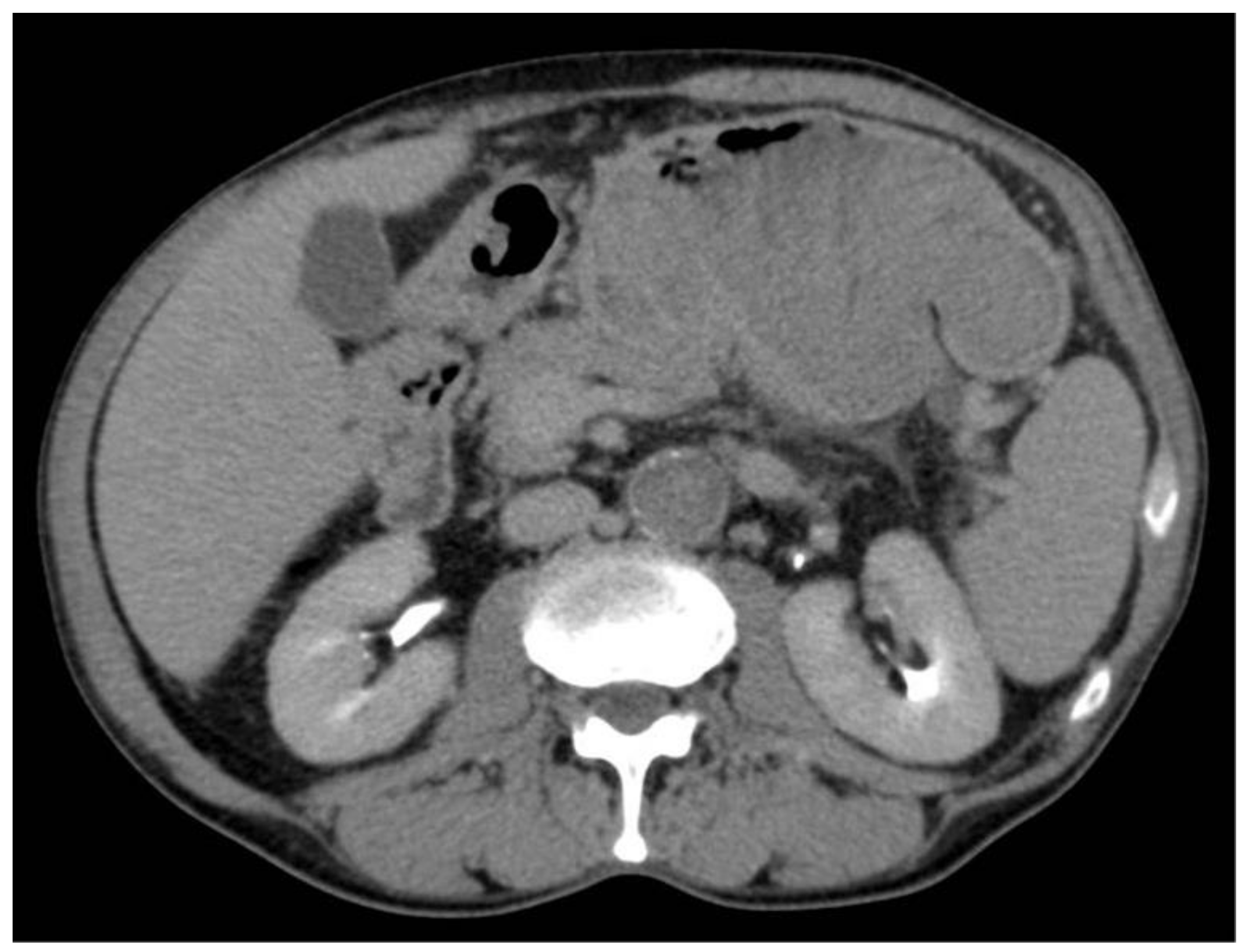 Surgeries 04 00009 g003