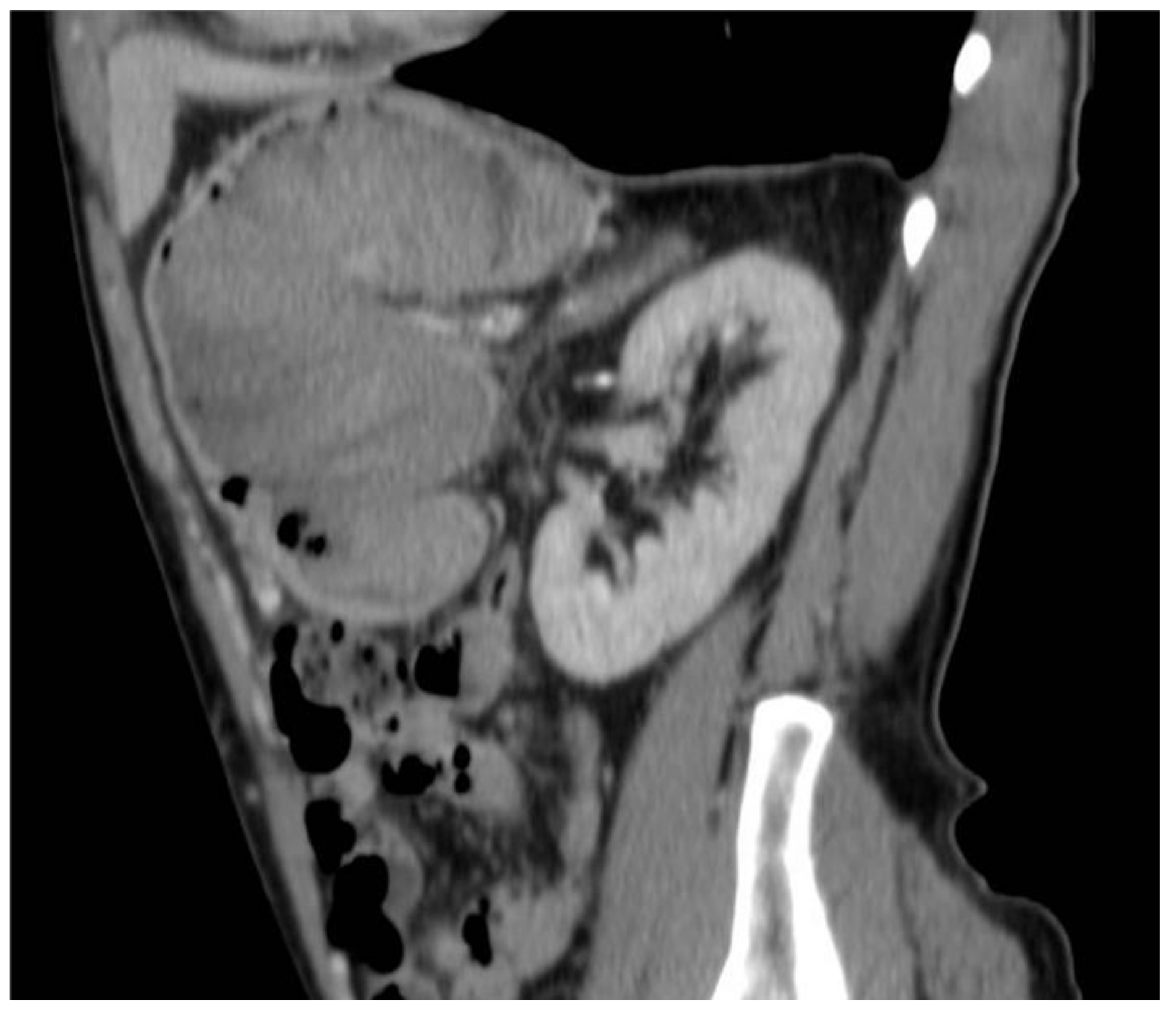 Surgeries 04 00009 g005