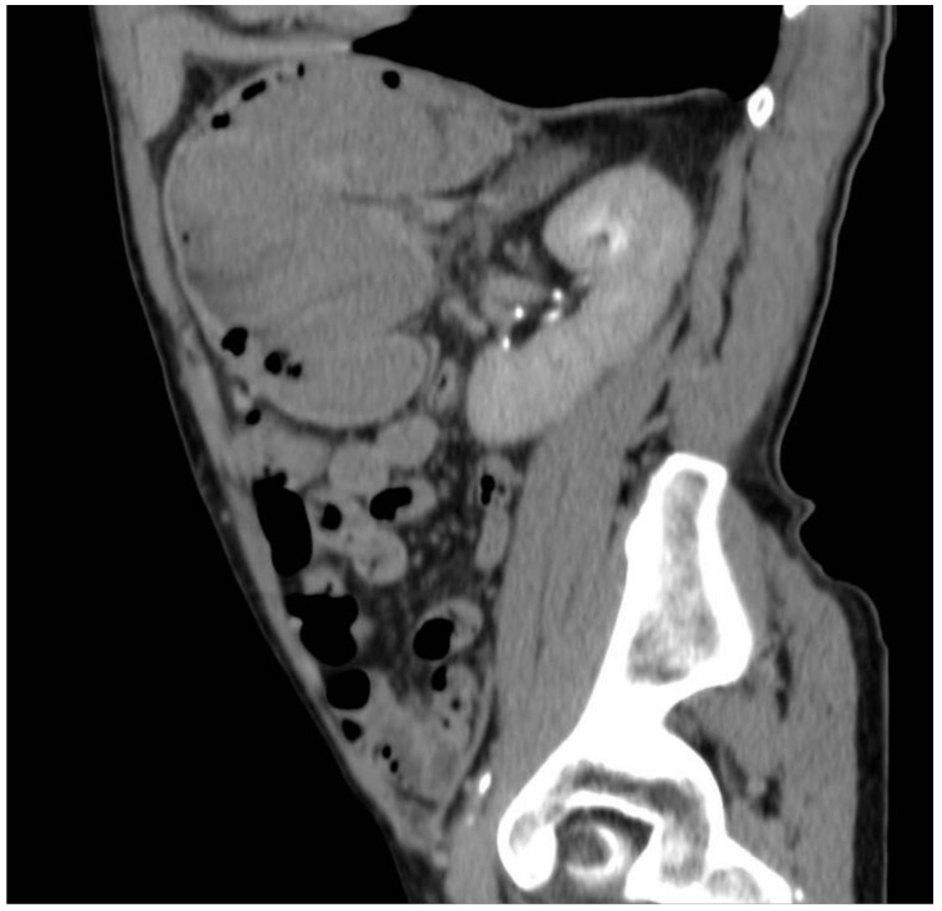 Surgeries 04 00009 g006