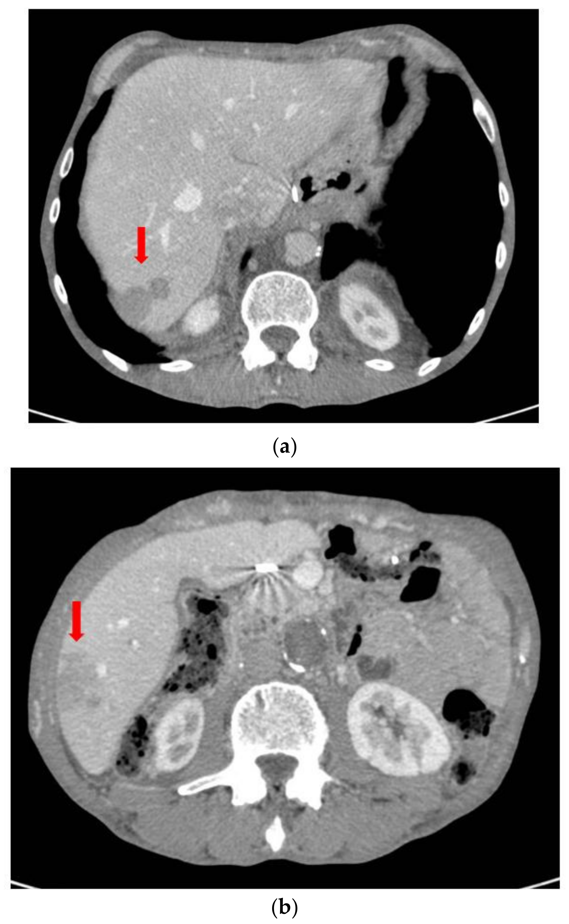 Surgeries 04 00009 g011