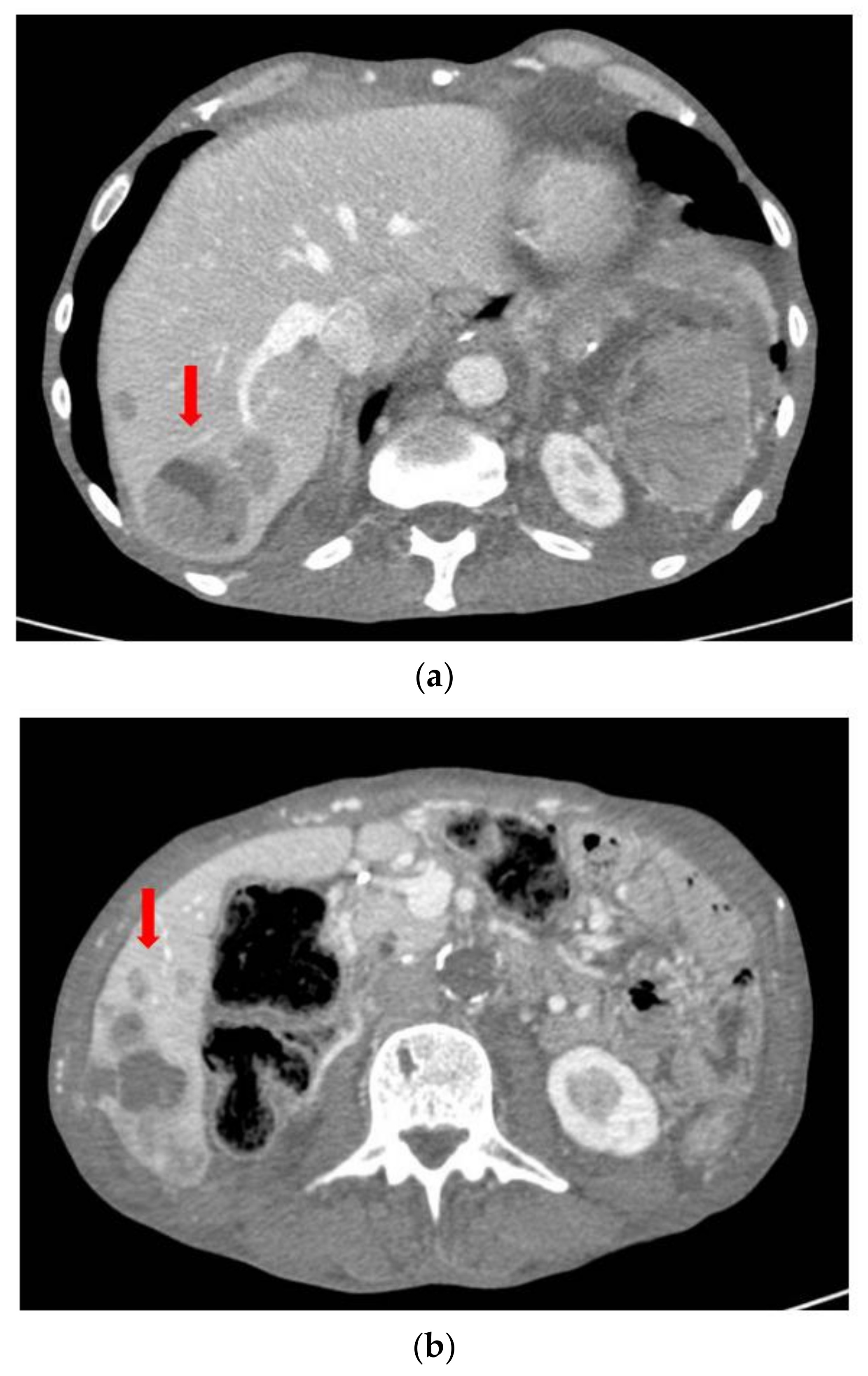 Surgeries 04 00009 g012