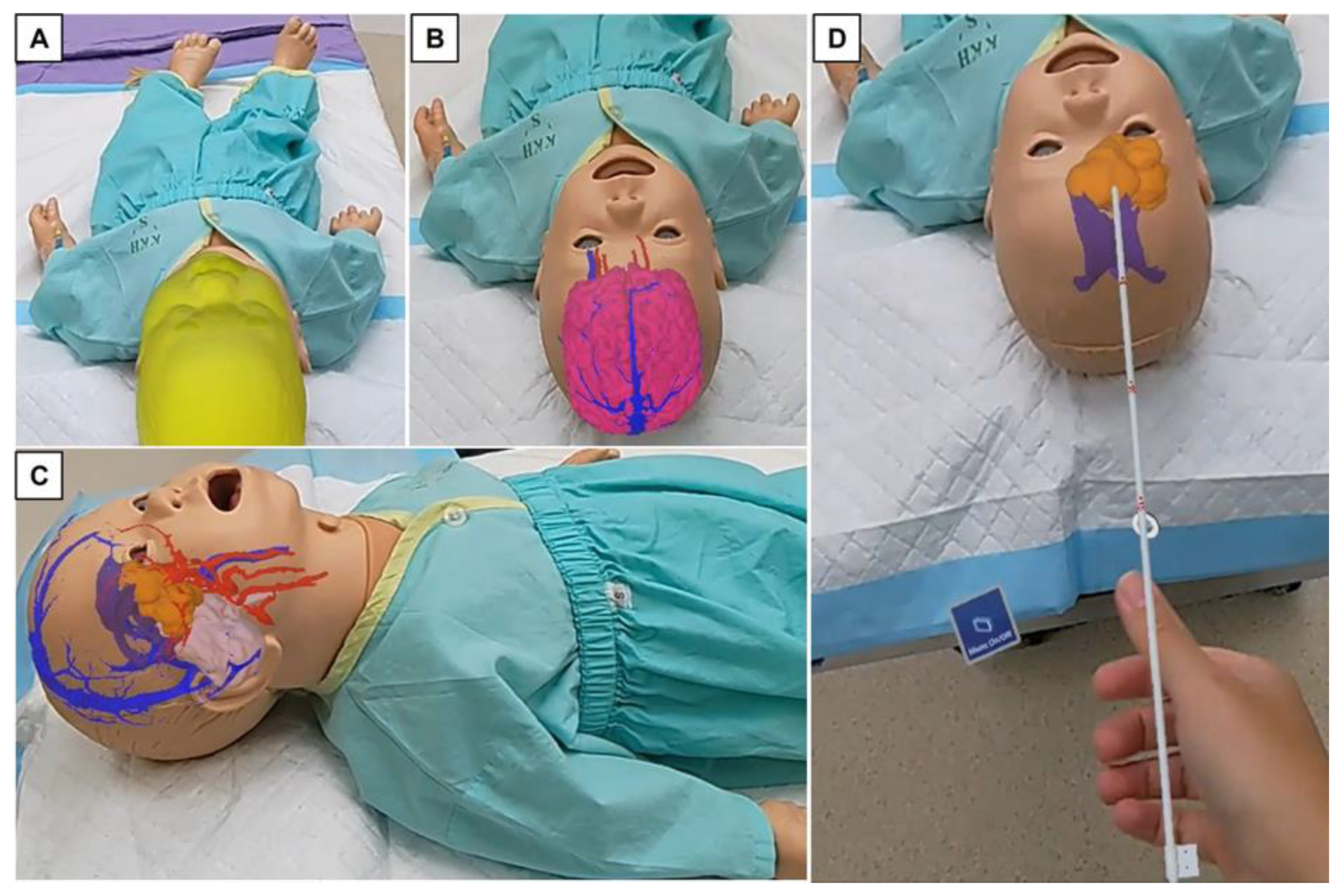Surgeries 04 00036 g003 Surgeries 04 00036 g003