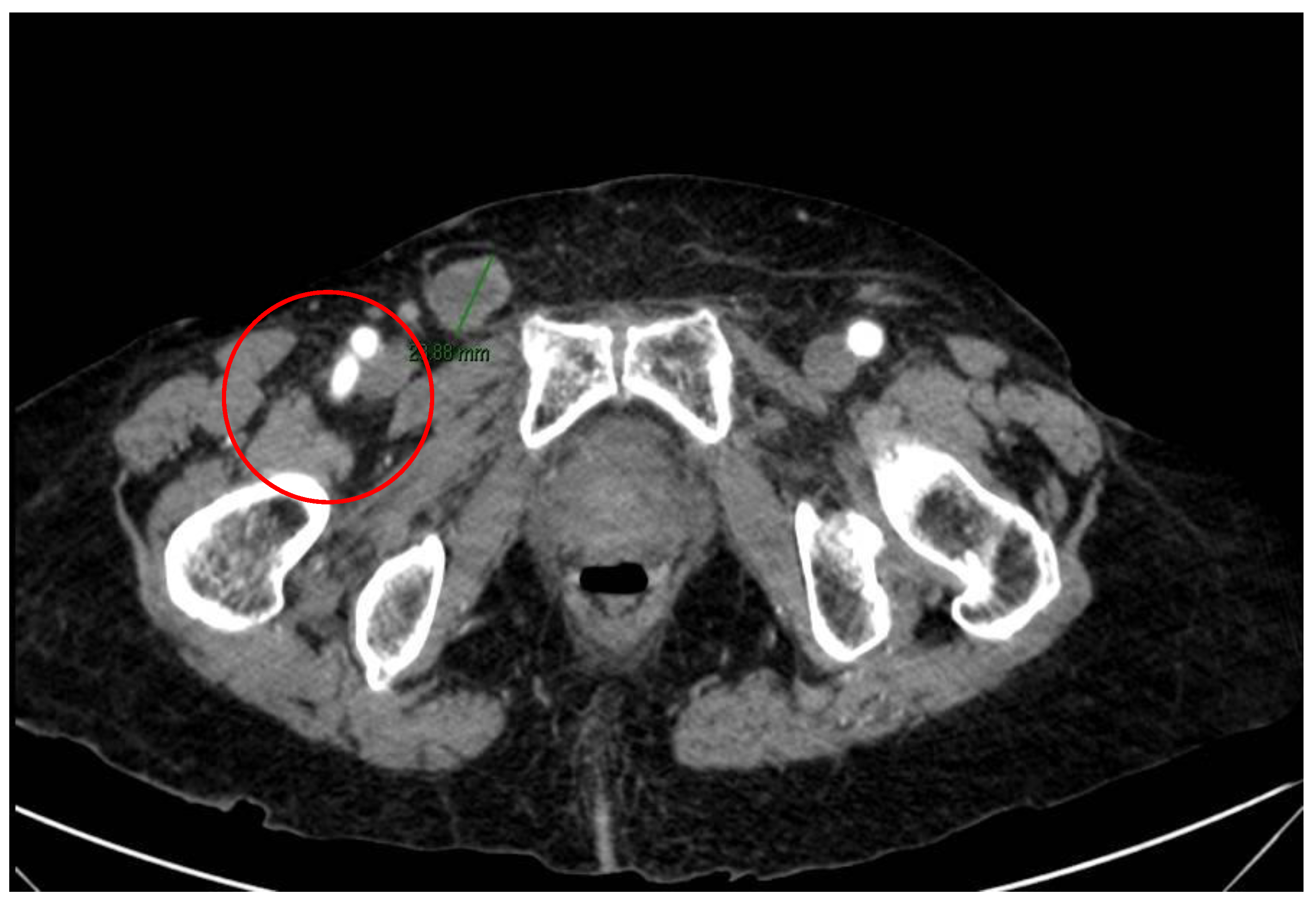 Surgeries 04 00038 g002 Surgeries 04 00038 g002