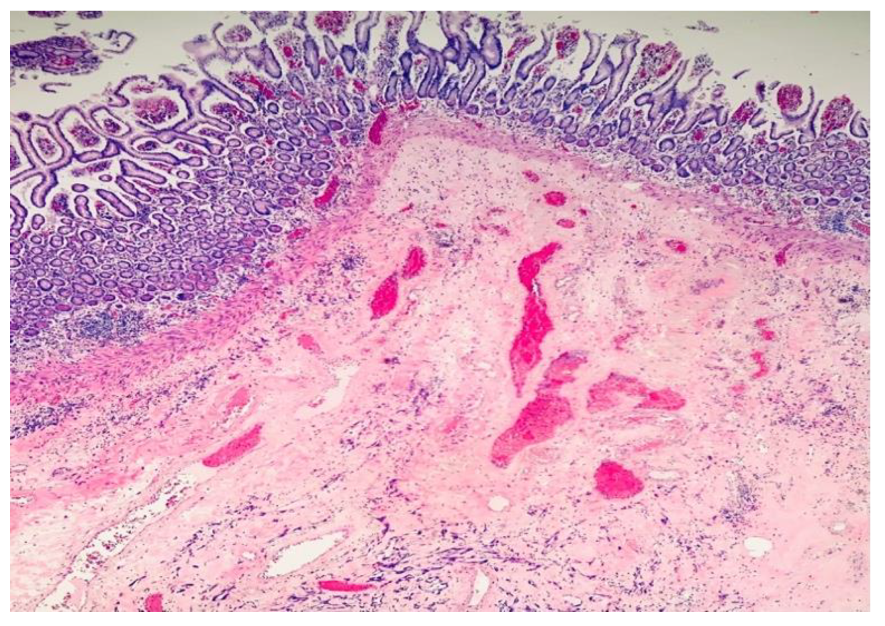 Surgeries 04 00038 g003 Surgeries 04 00038 g003