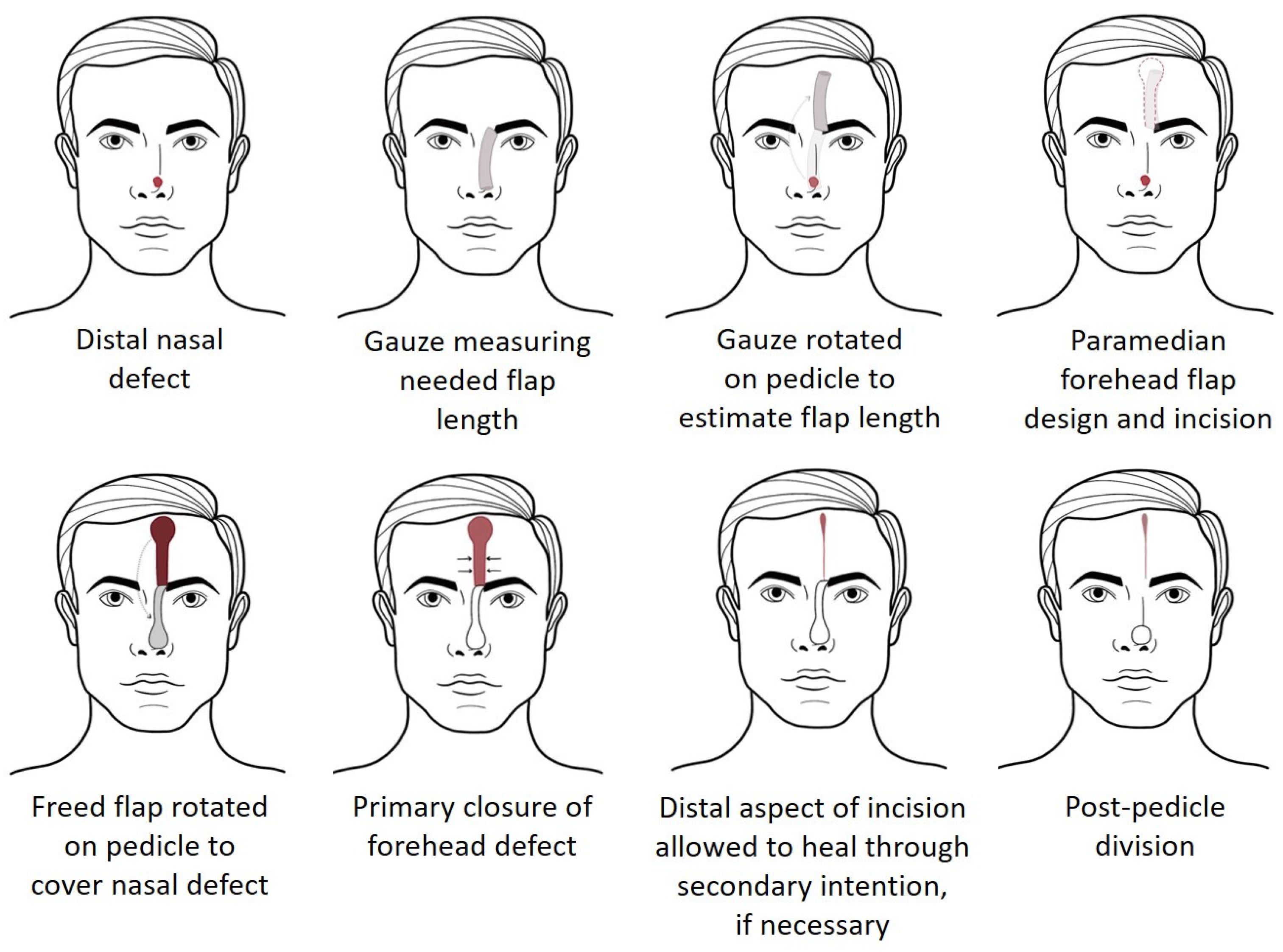Surgeries 05 00004 g001