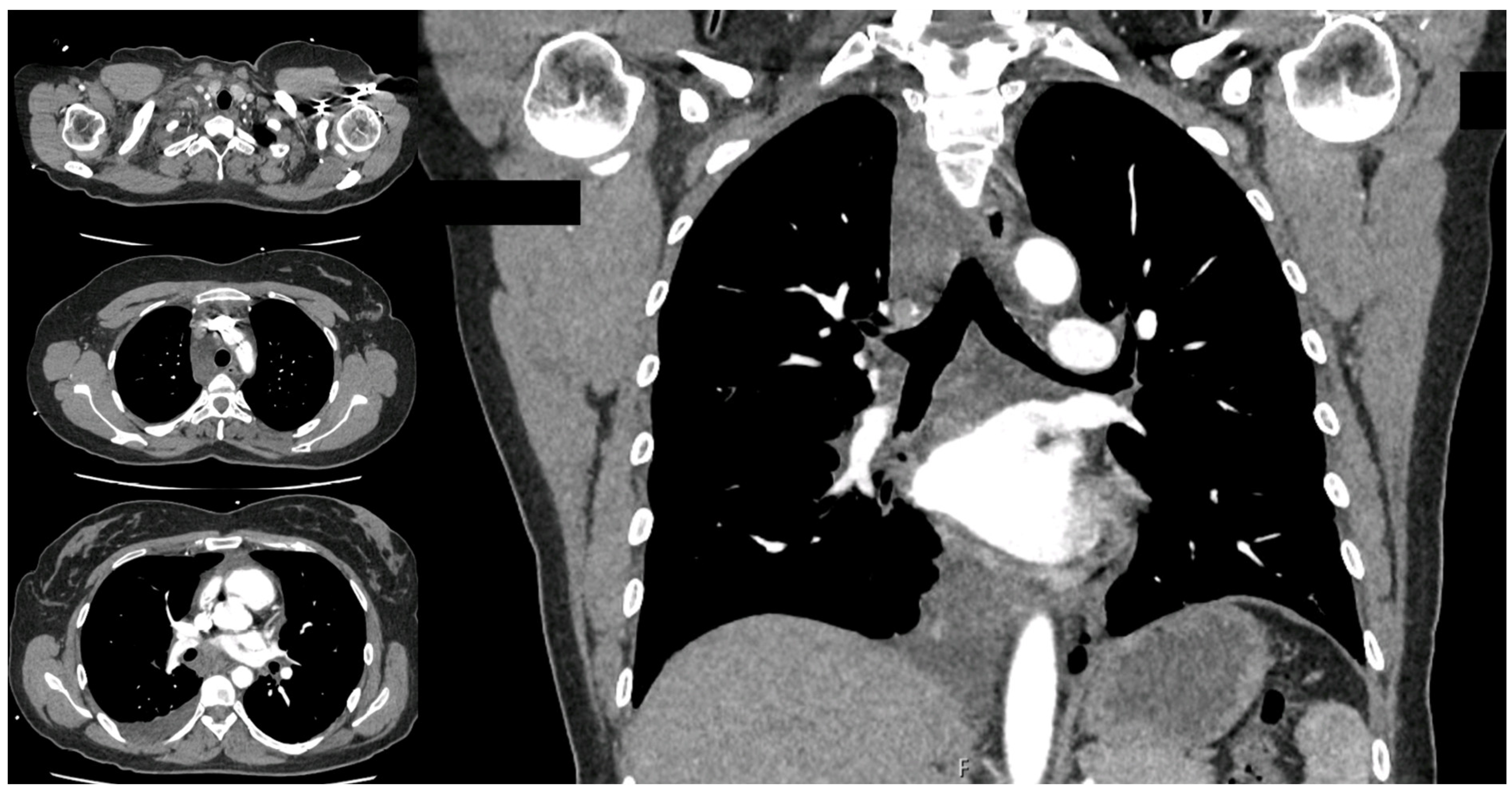 Surgeries 05 00026 g001 Surgeries 05 00026 g001