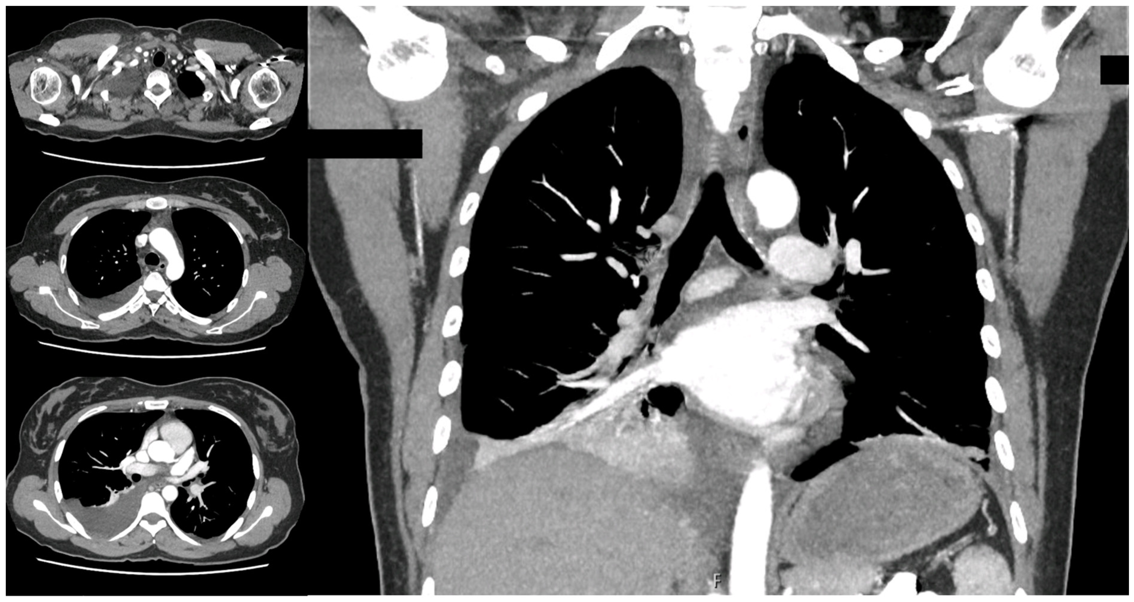 Surgeries 05 00026 g002 Surgeries 05 00026 g002