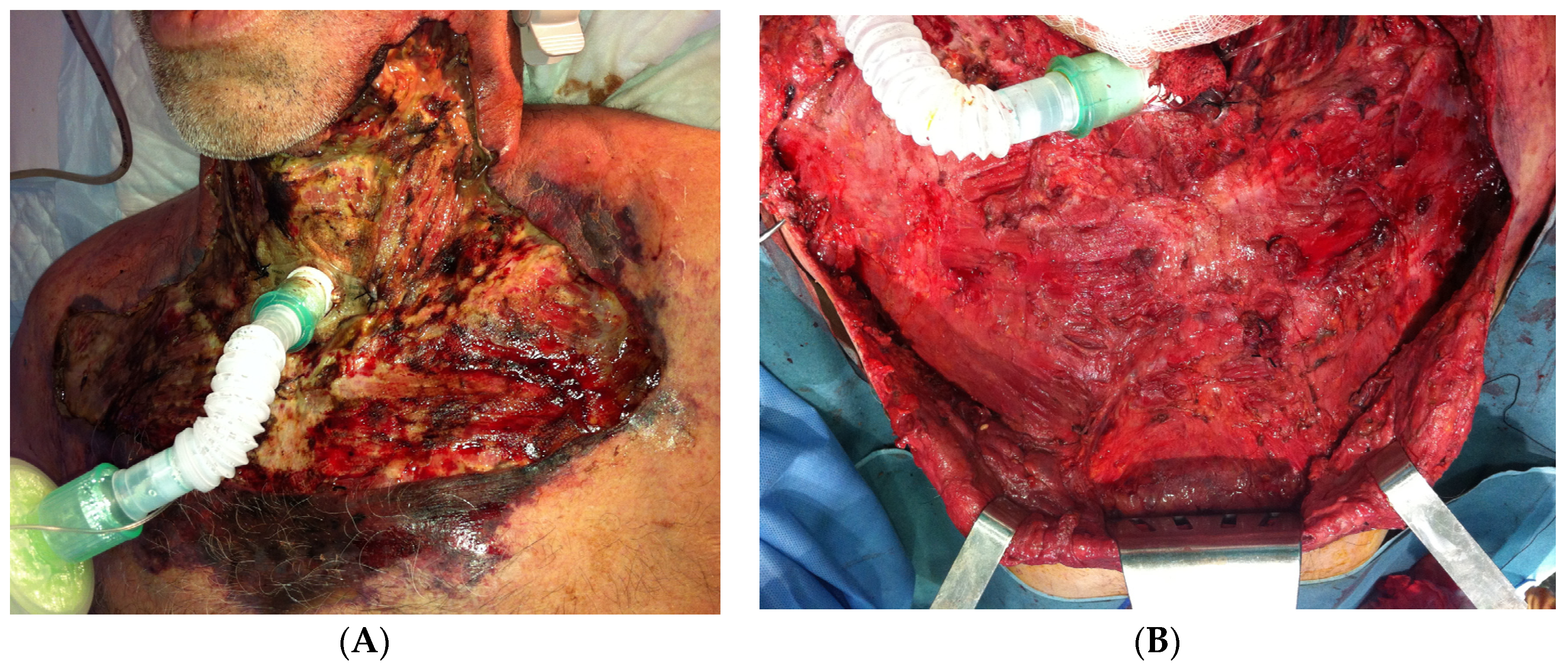 Surgeries 05 00042 g003