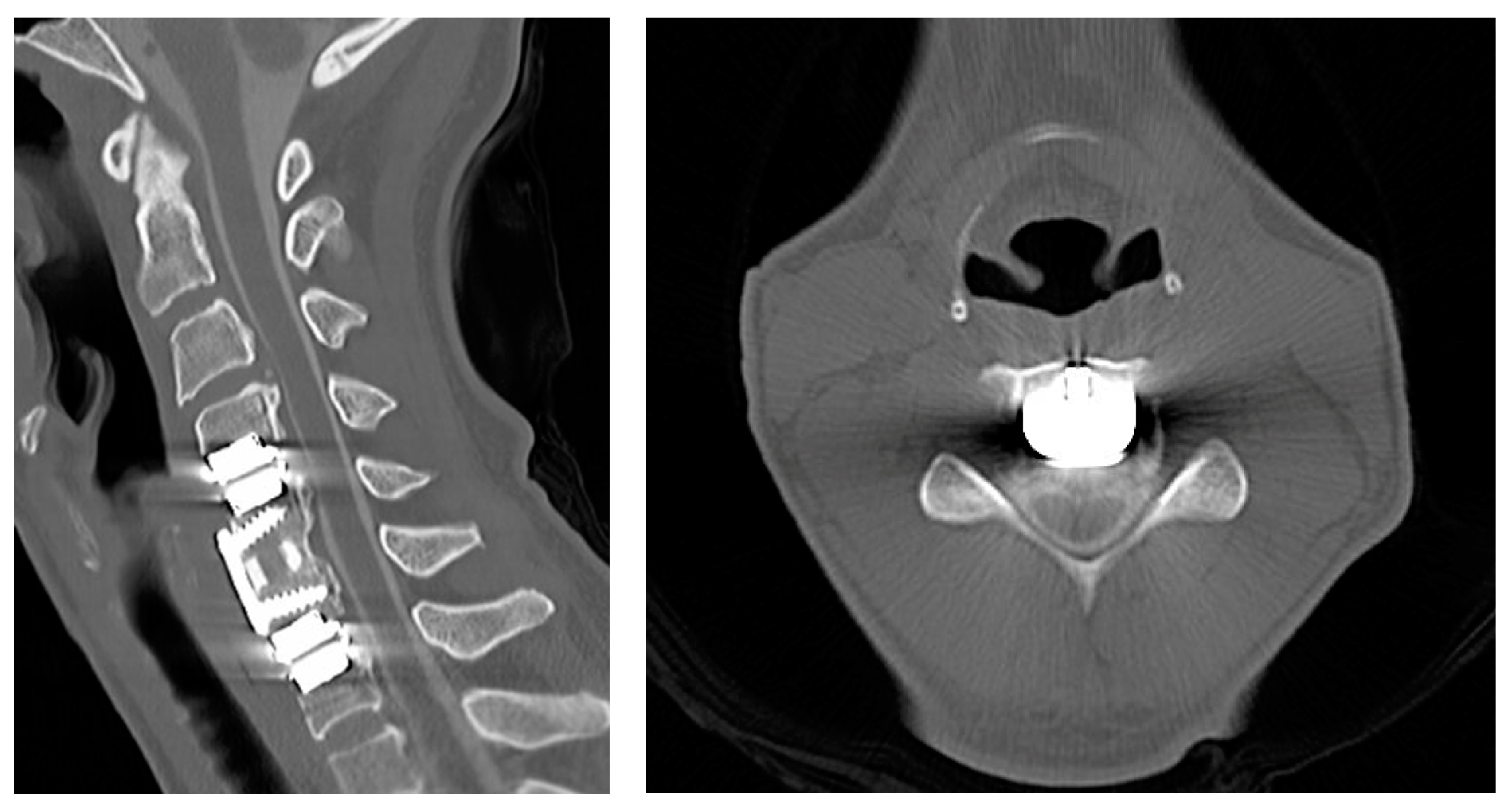 Surgeries 05 00056 g003