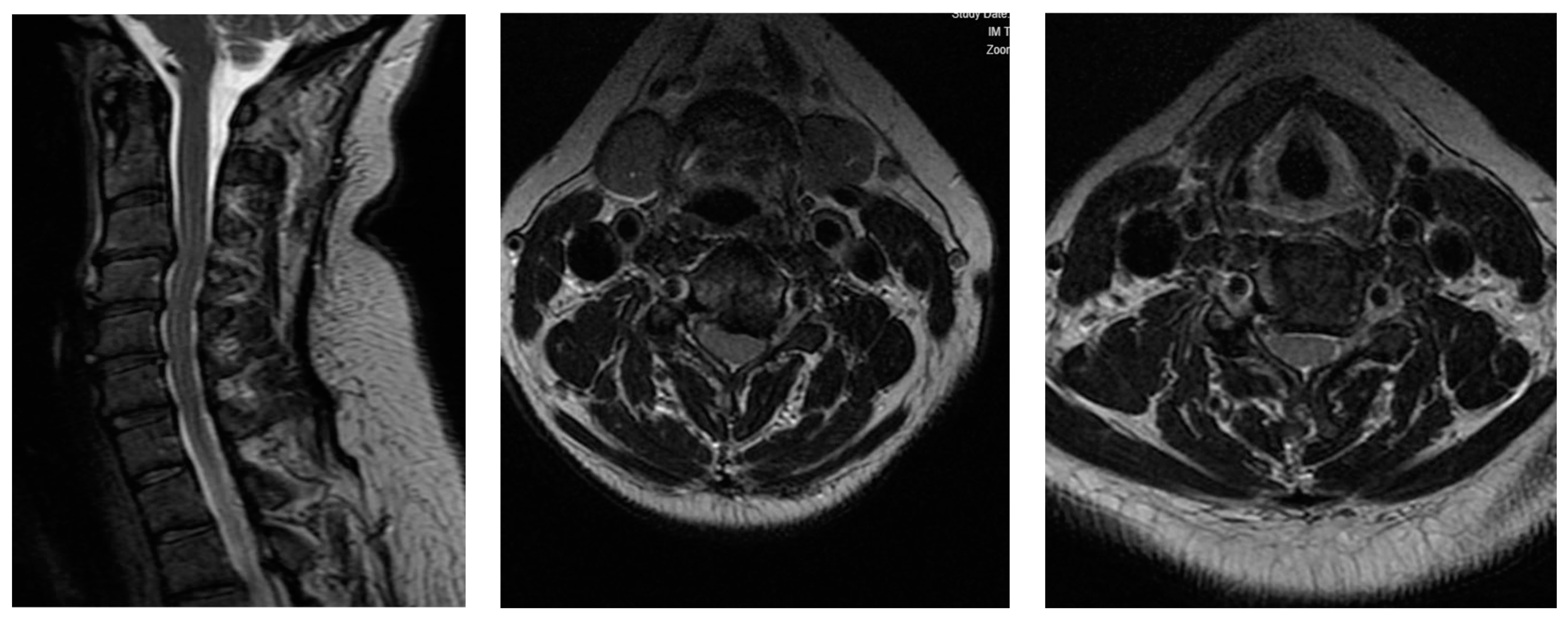 Surgeries 05 00056 g004