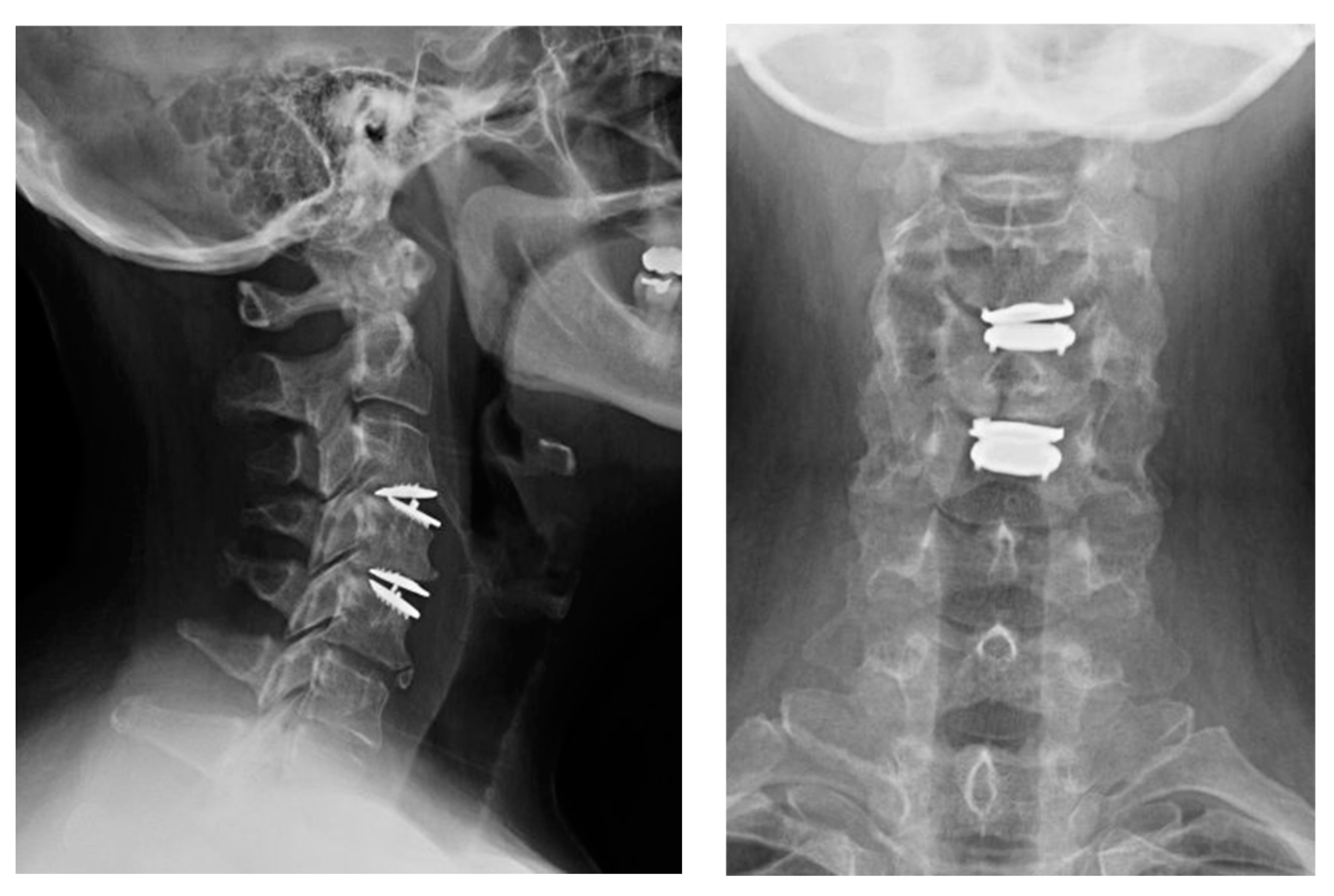 Surgeries 05 00056 g005