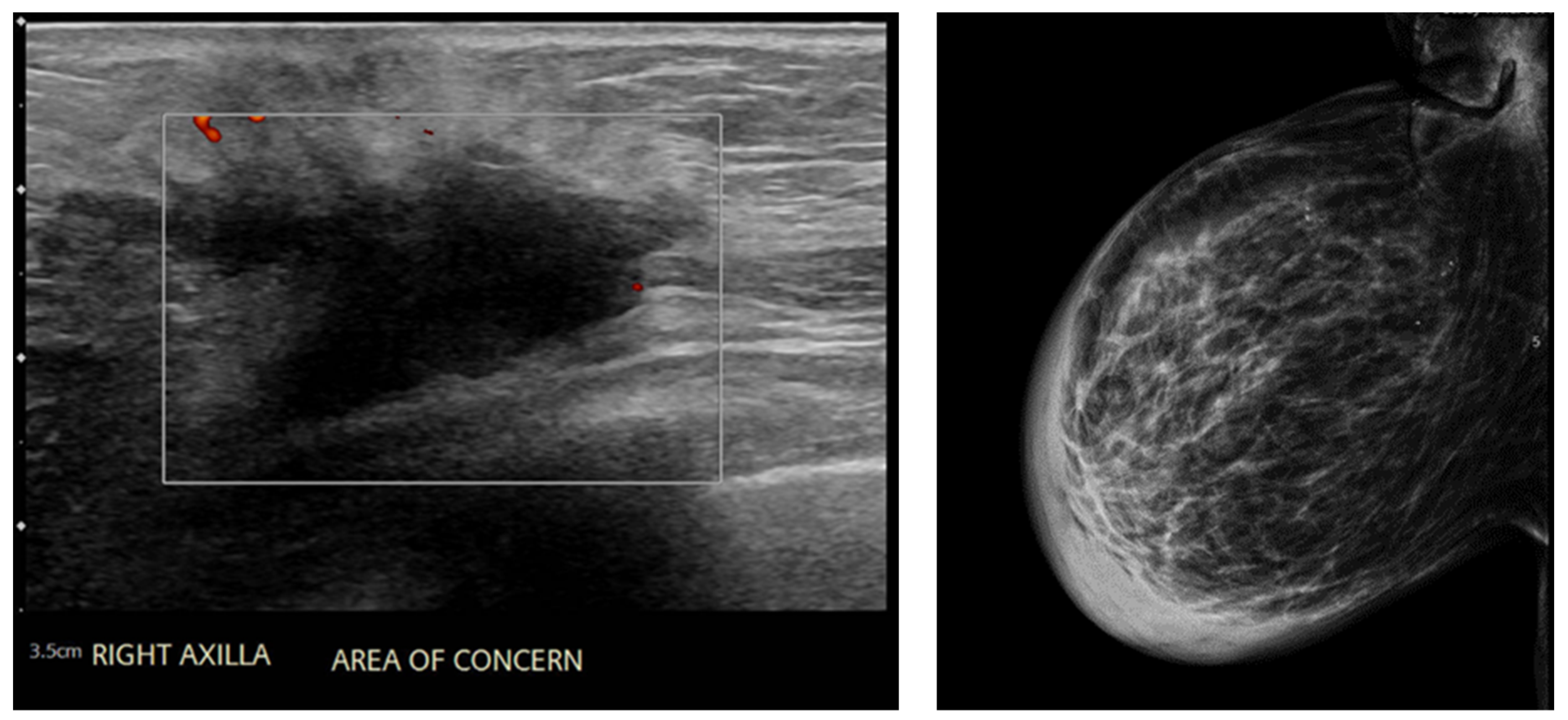 Surgeries 05 00060 g001 Surgeries 05 00060 g001