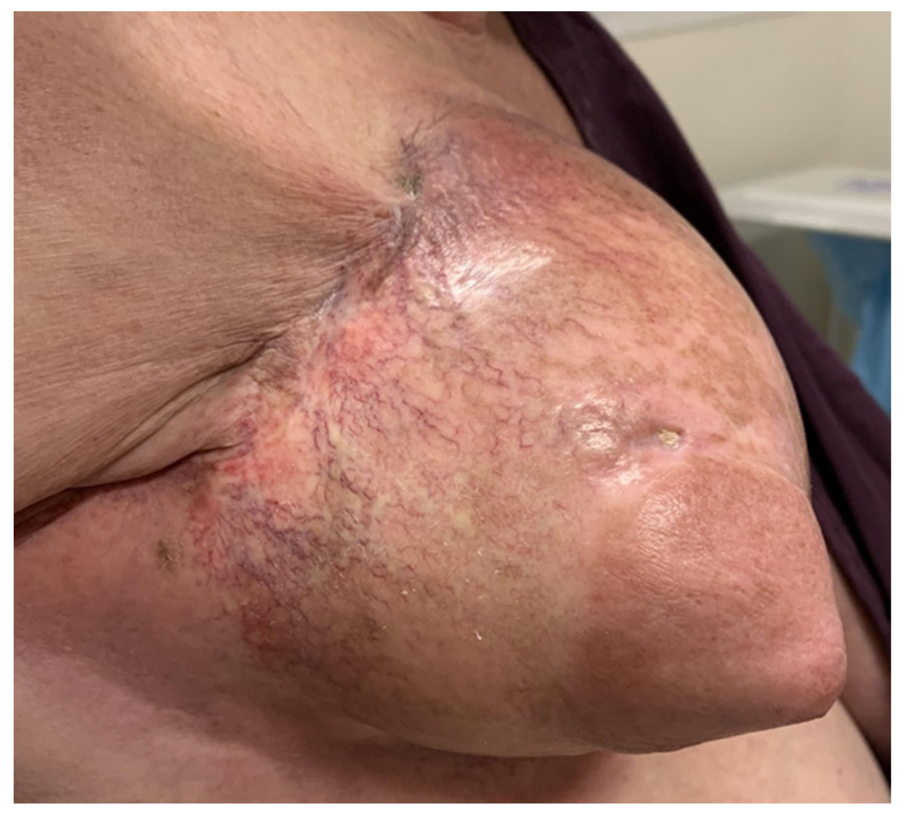 Surgeries 05 00060 g002 Surgeries 05 00060 g002