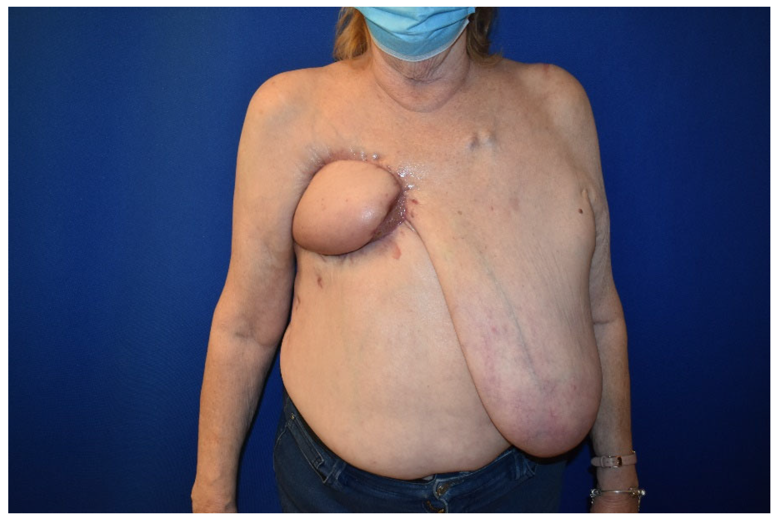 Surgeries 05 00060 g004 Surgeries 05 00060 g004