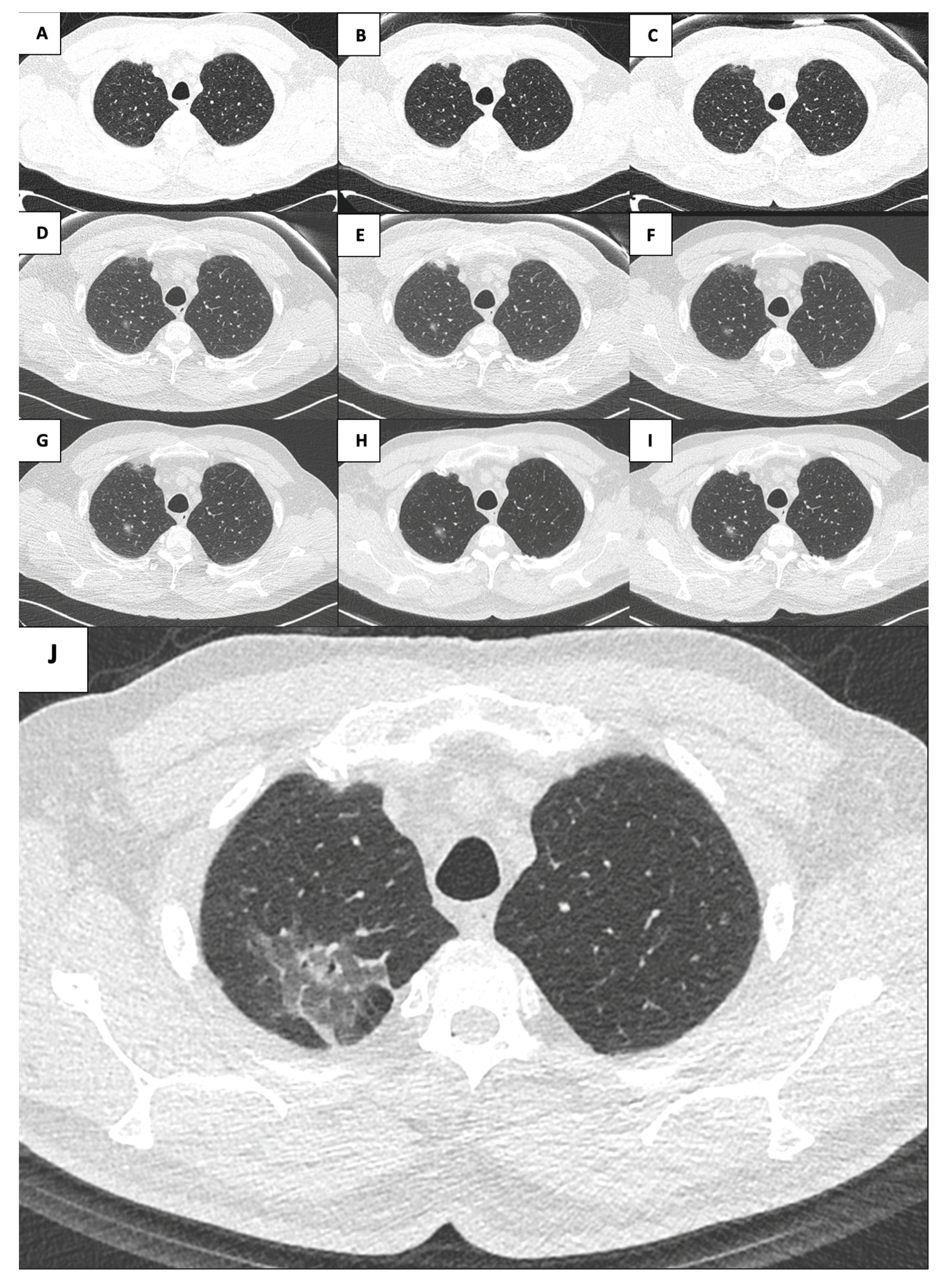 Surgeries 05 00070 g001