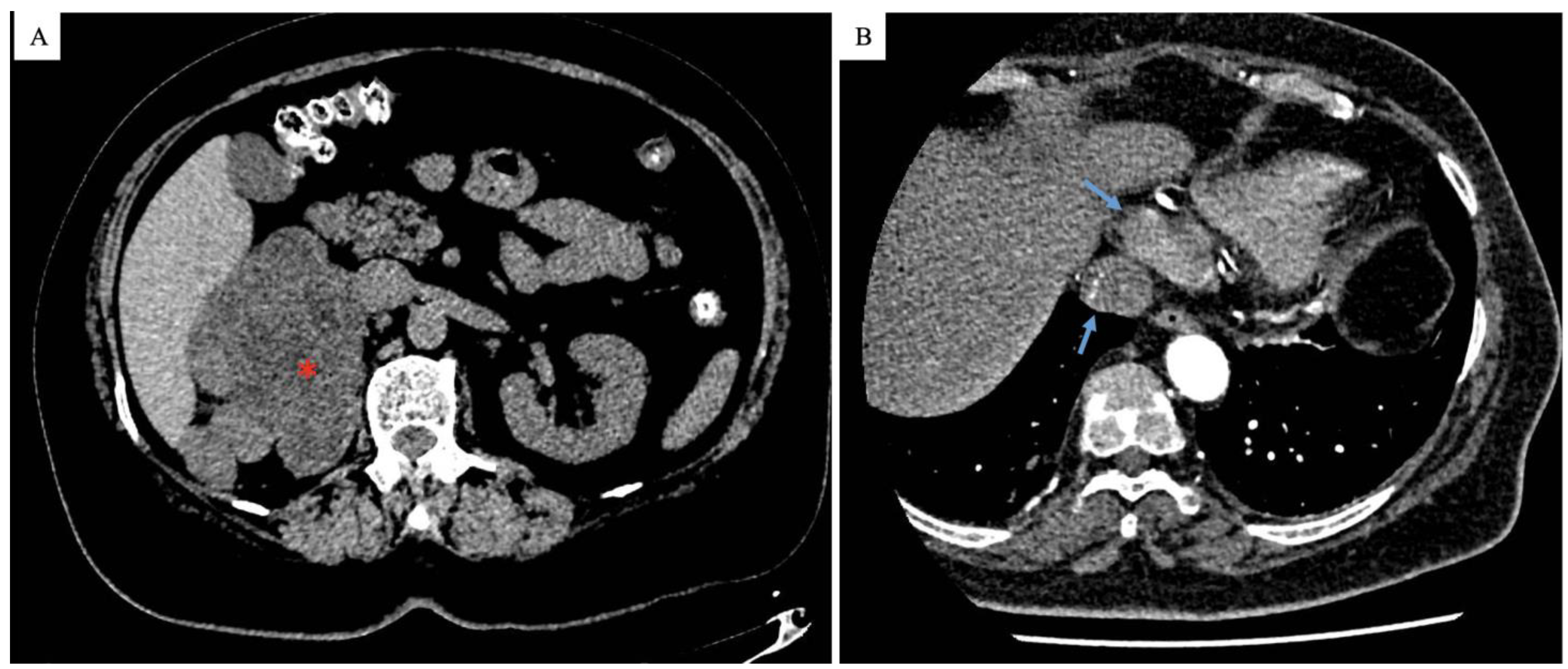 Surgeries 05 00087 g001 Surgeries 05 00087 g001