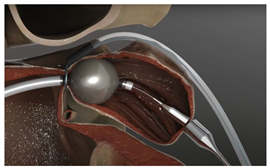 Surgeries 06 00015 i003