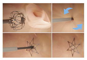 Surgeries 06 00015 i011