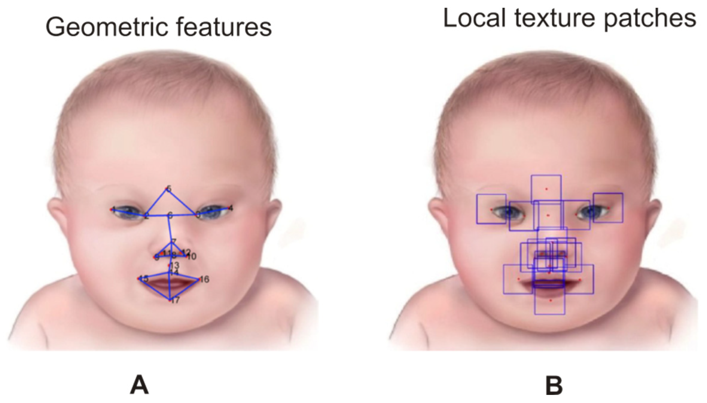 Symmetry | Free Full-Text | Down Syndrome Face Recognition: A Review