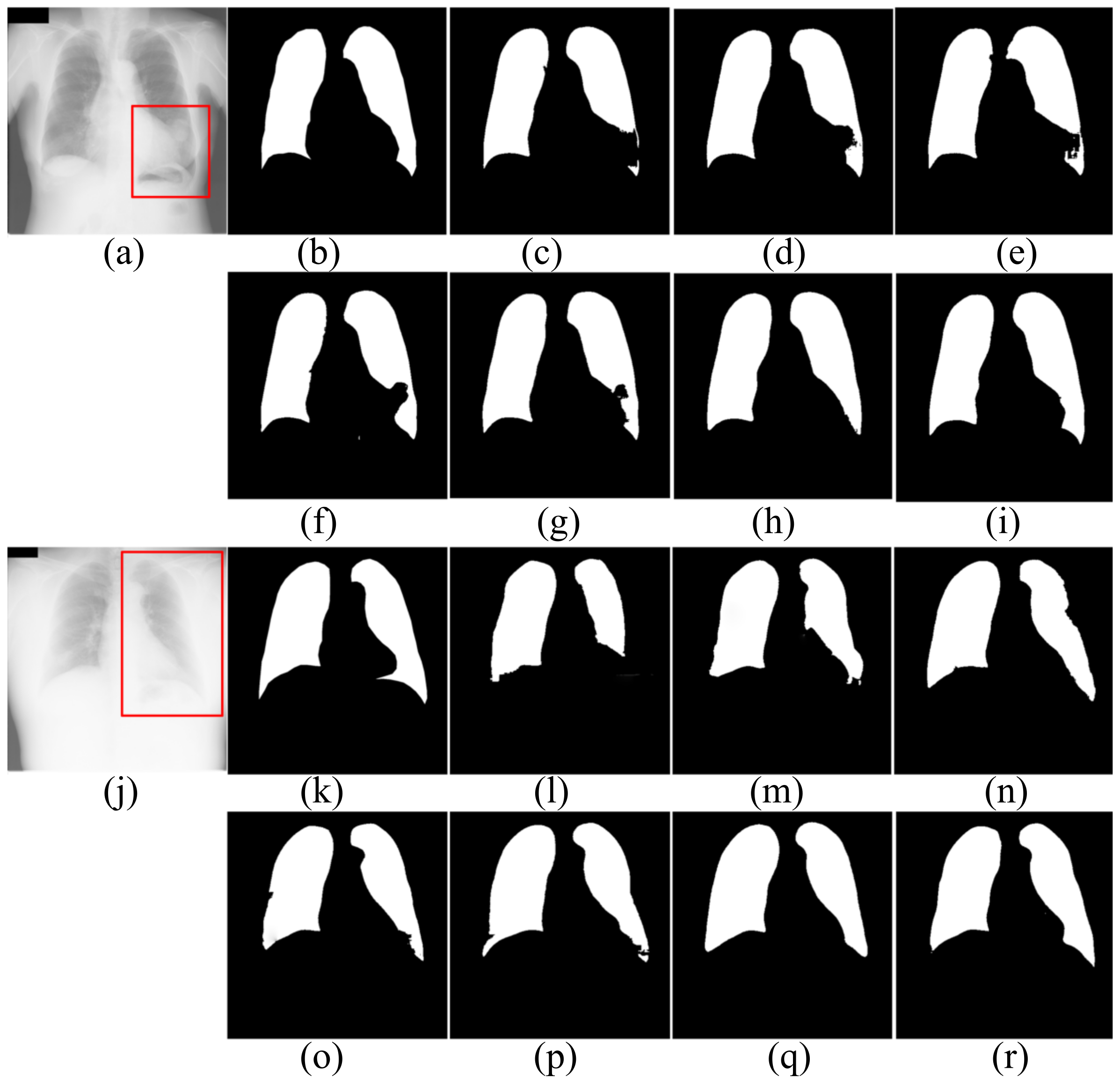 Symmetry Free Full Text Automatic Lung Segmentation Algorithm On Chest X Ray Images Based On Fusion Variational Auto Encoder And Three Terminal Attention Mechanism Html