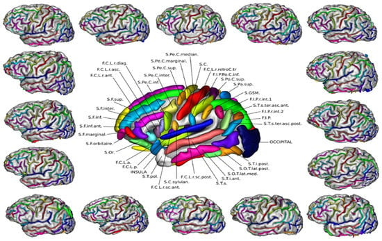 The shape, not size, of our ancestors' brains may have helped them