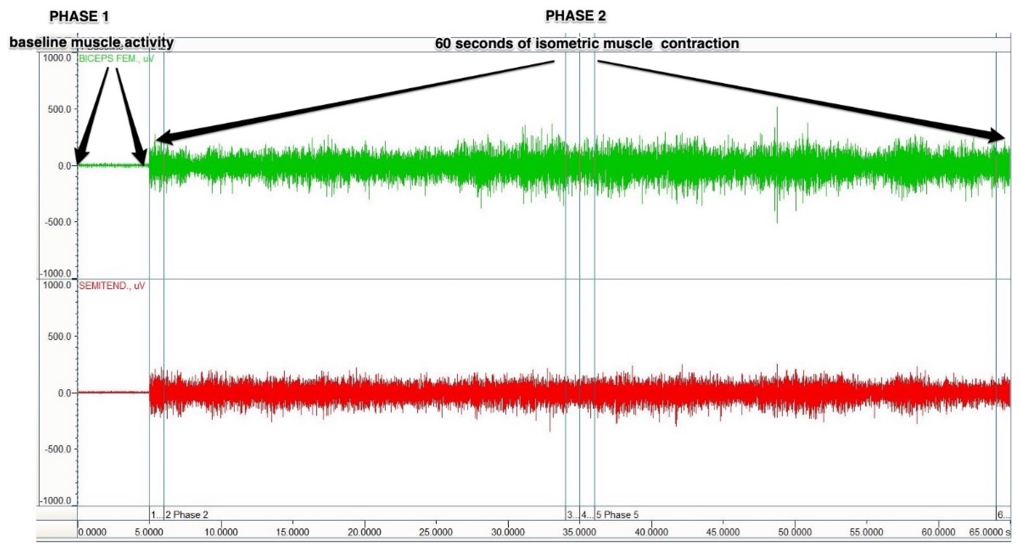 Symmetry 14 00052 g004