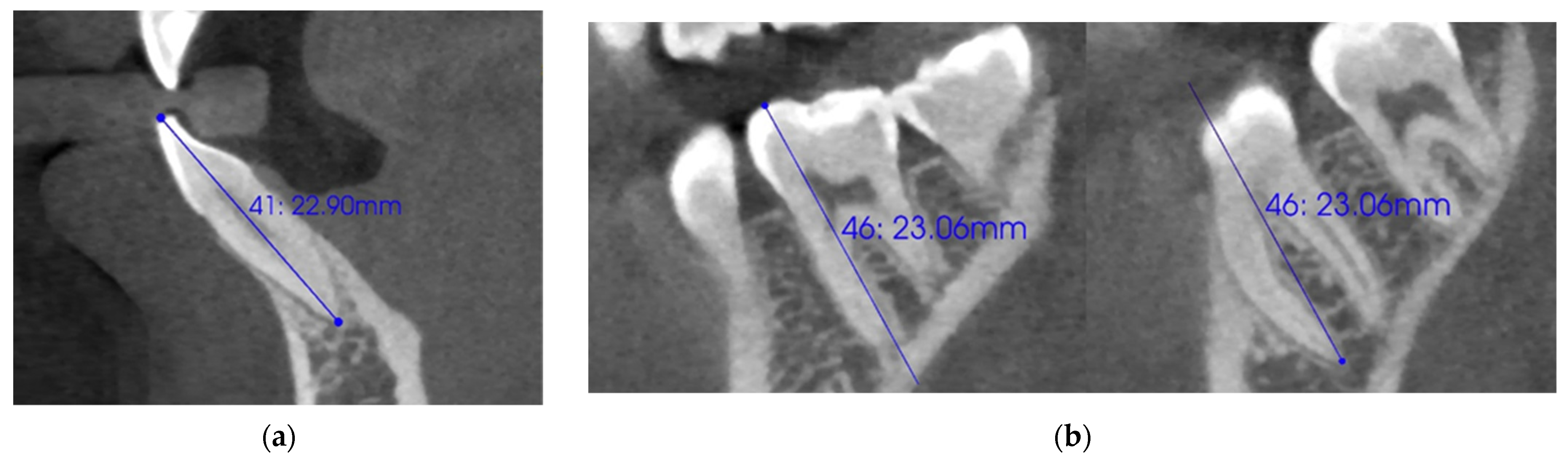 The X-ray scanner is used to investigate a discrepancy in sex