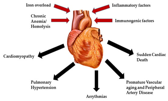 Thalassemia Reports | Free Full-Text | Cardiovascular Complications in ...