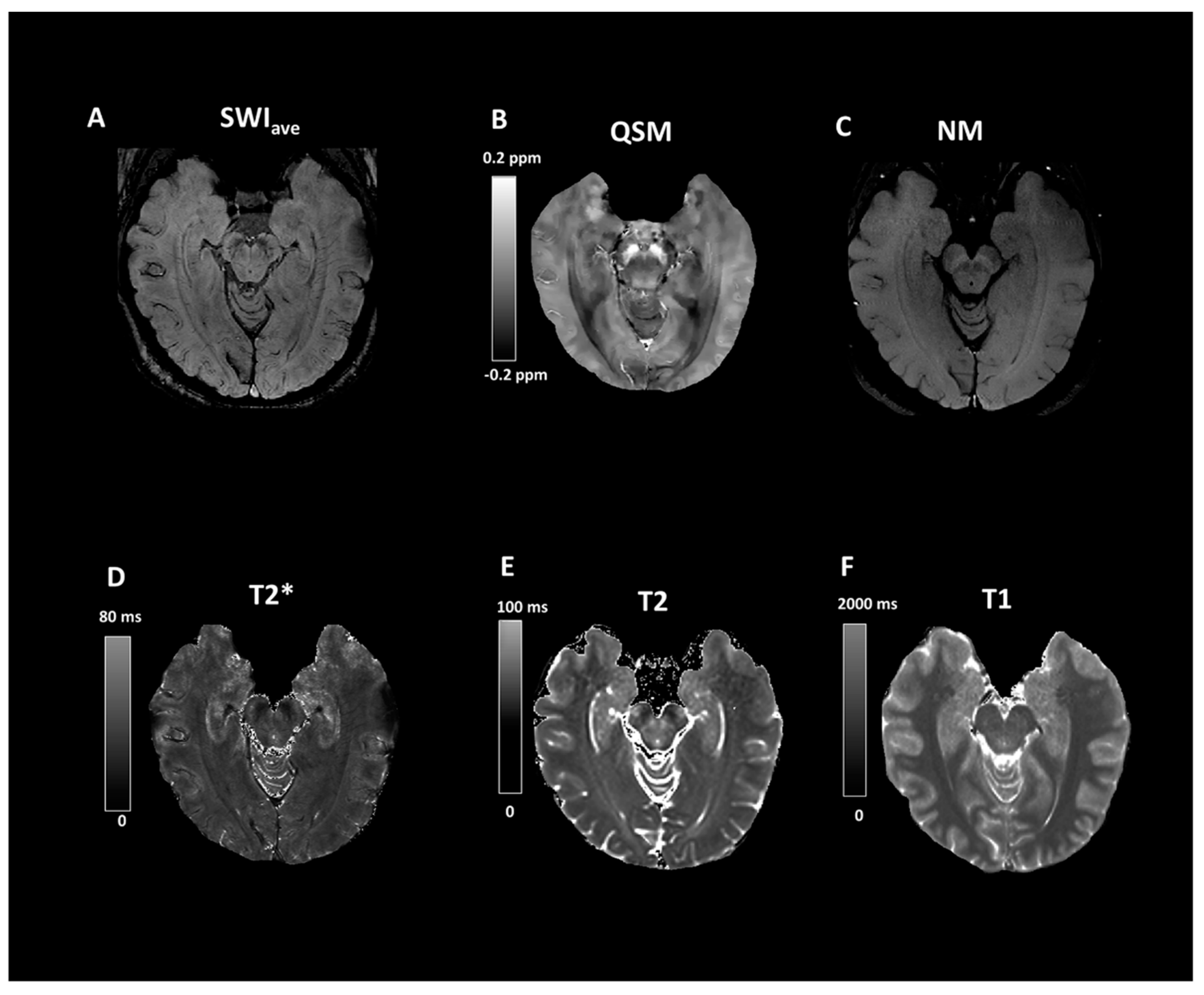 Tomography 07 00010 g005