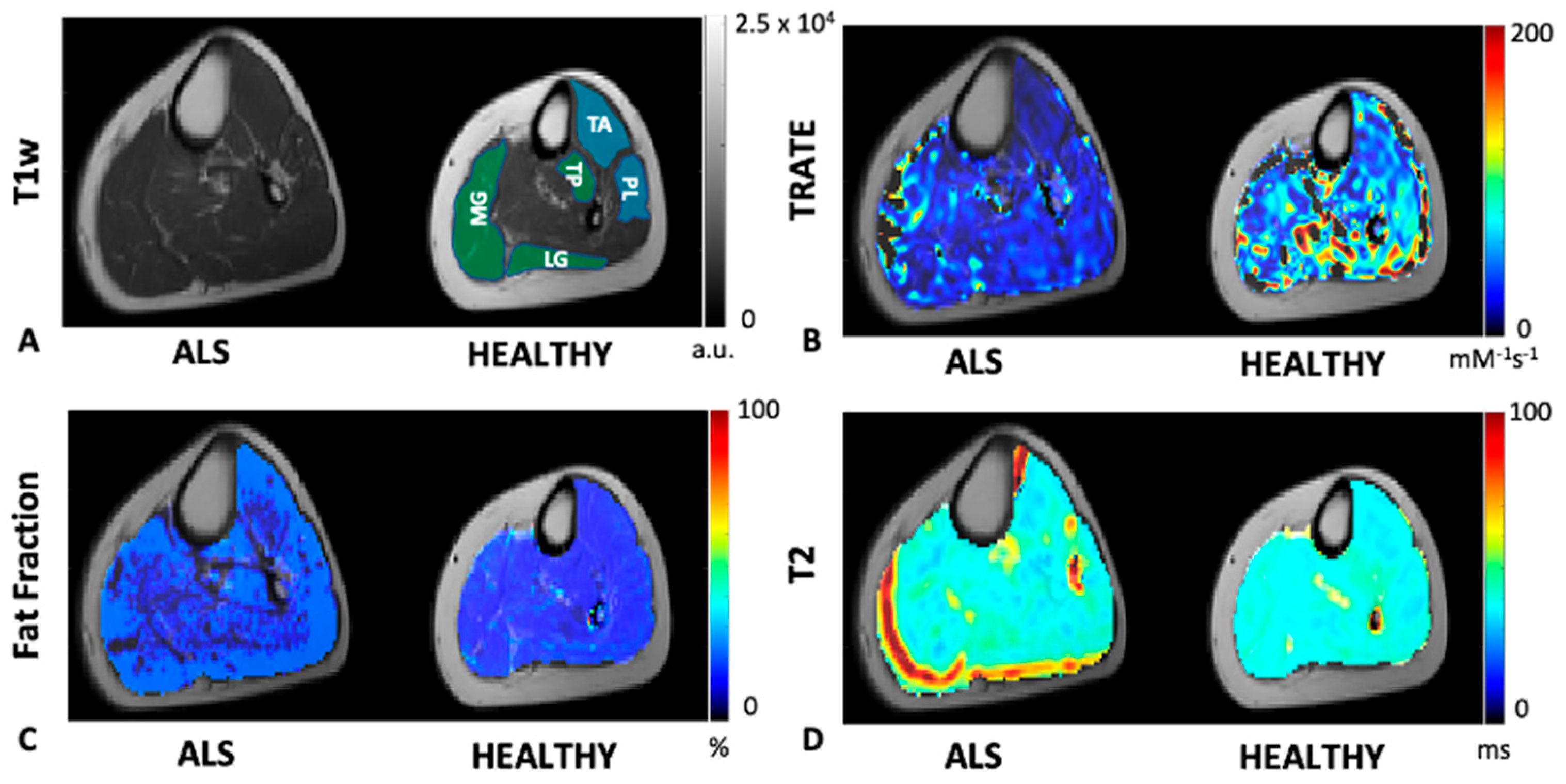 Tomography 07 00015 g002 Tomography 07 00015 g002