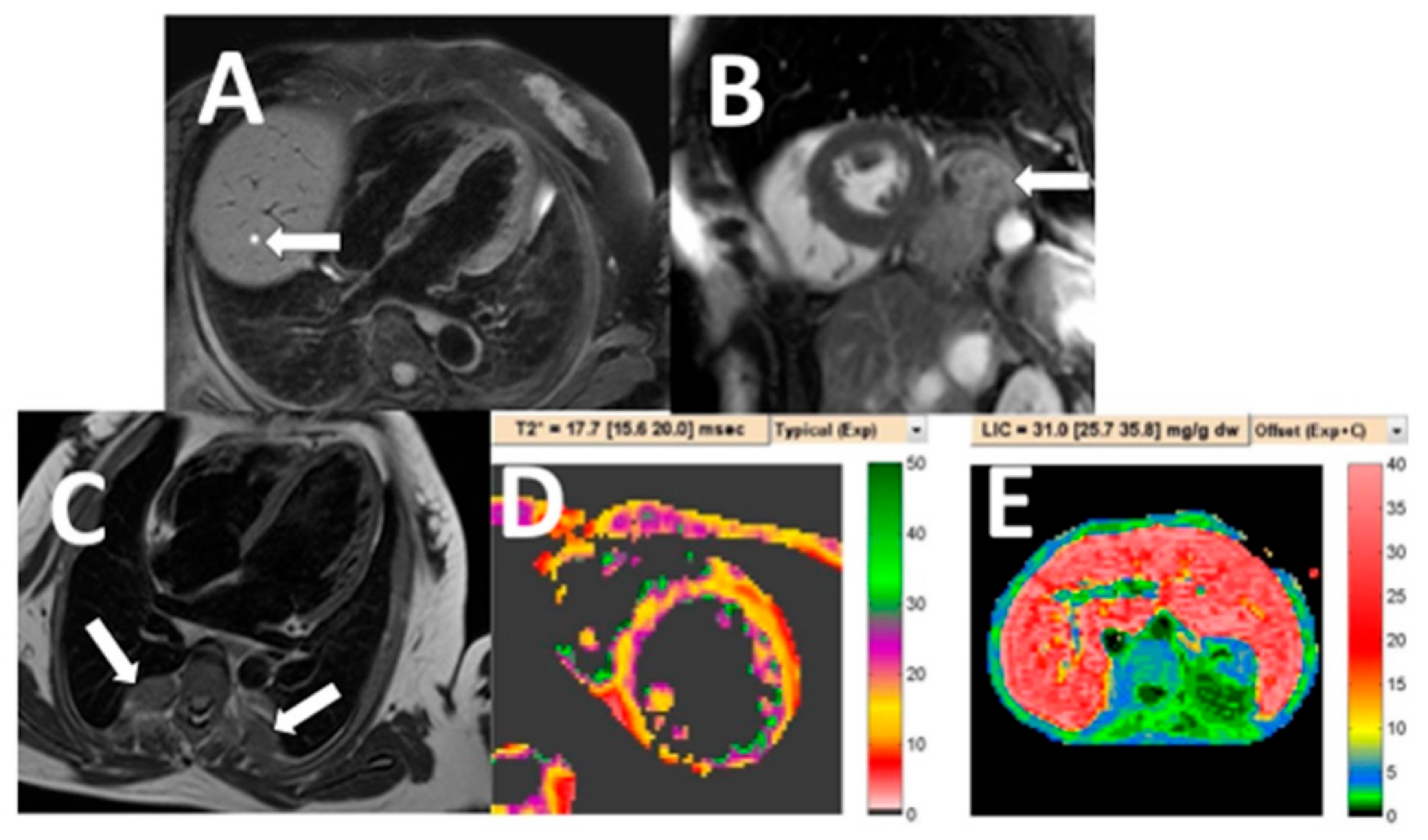 Tomography 07 00018 g001 Tomography 07 00018 g001