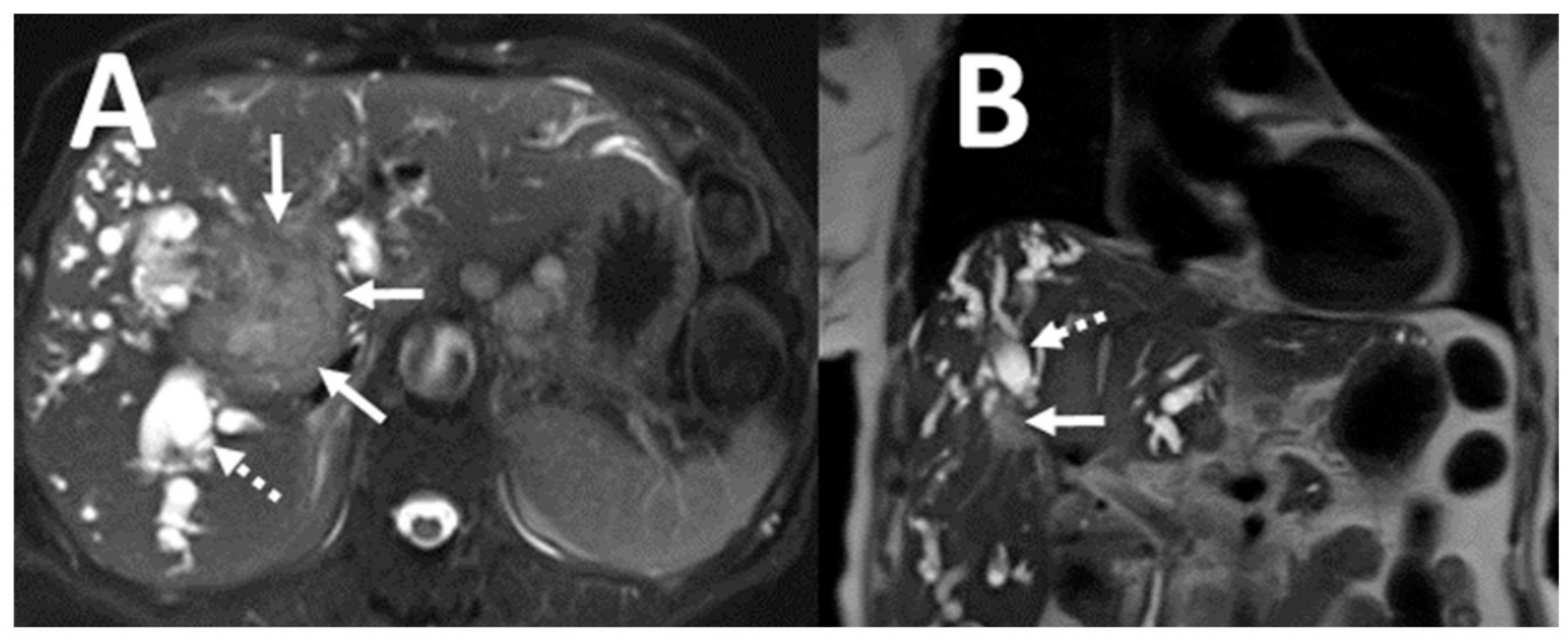 Tomography 07 00018 g002 Tomography 07 00018 g002