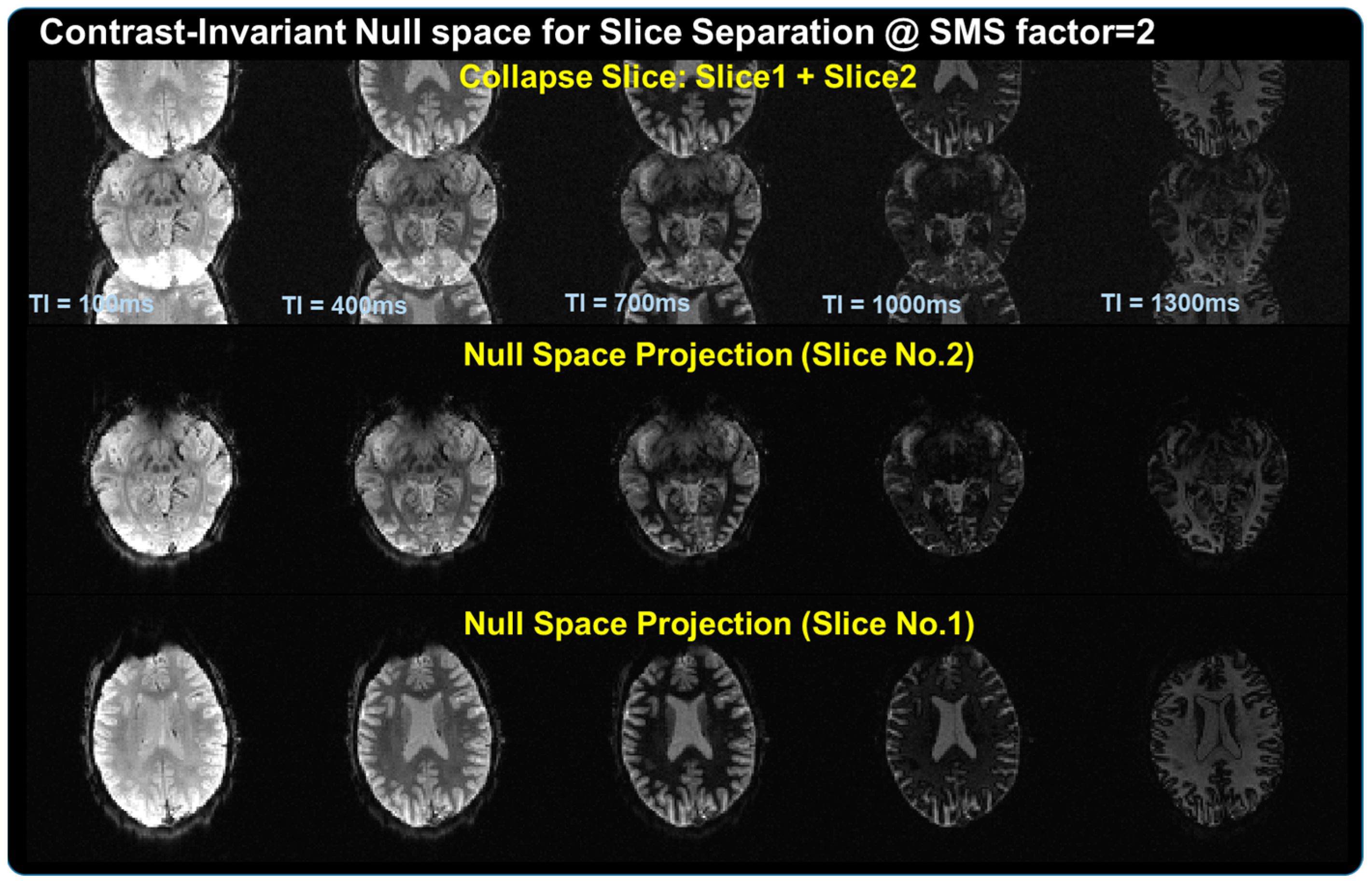 M4Raw: A multi-contrast, multi-repetition, multi-channel MRI k-space  dataset for low-field MRI research