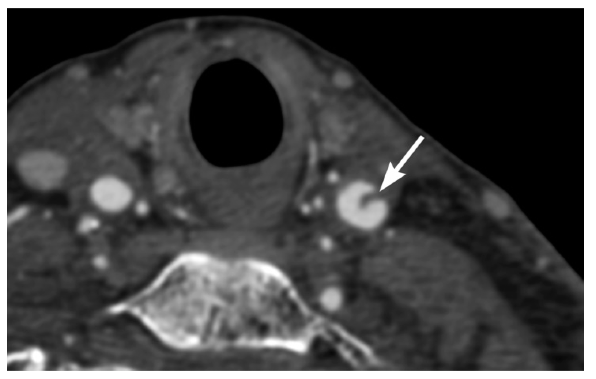 Tomography 08 00033 g002 Tomography 08 00033 g002