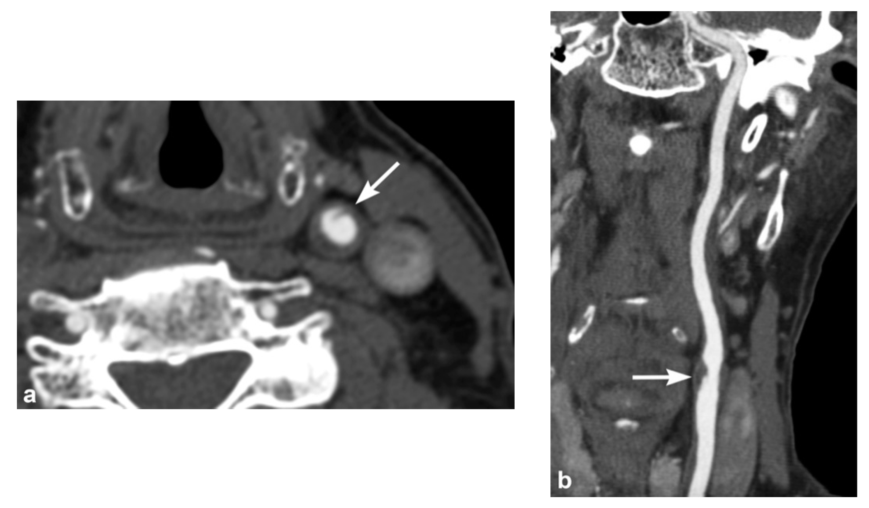 Tomography 08 00033 g003 Tomography 08 00033 g003