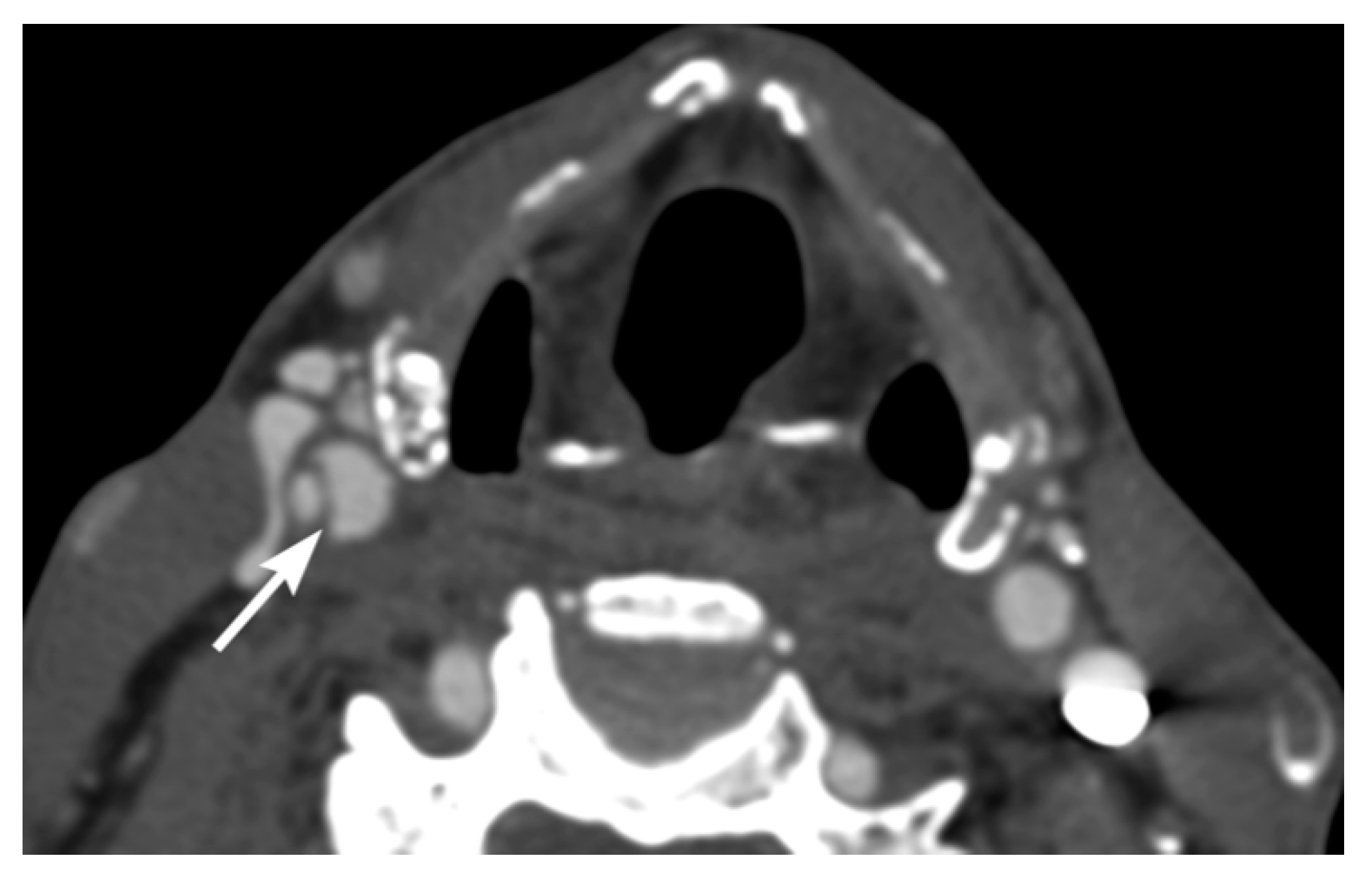Tomography 08 00033 g004 Tomography 08 00033 g004