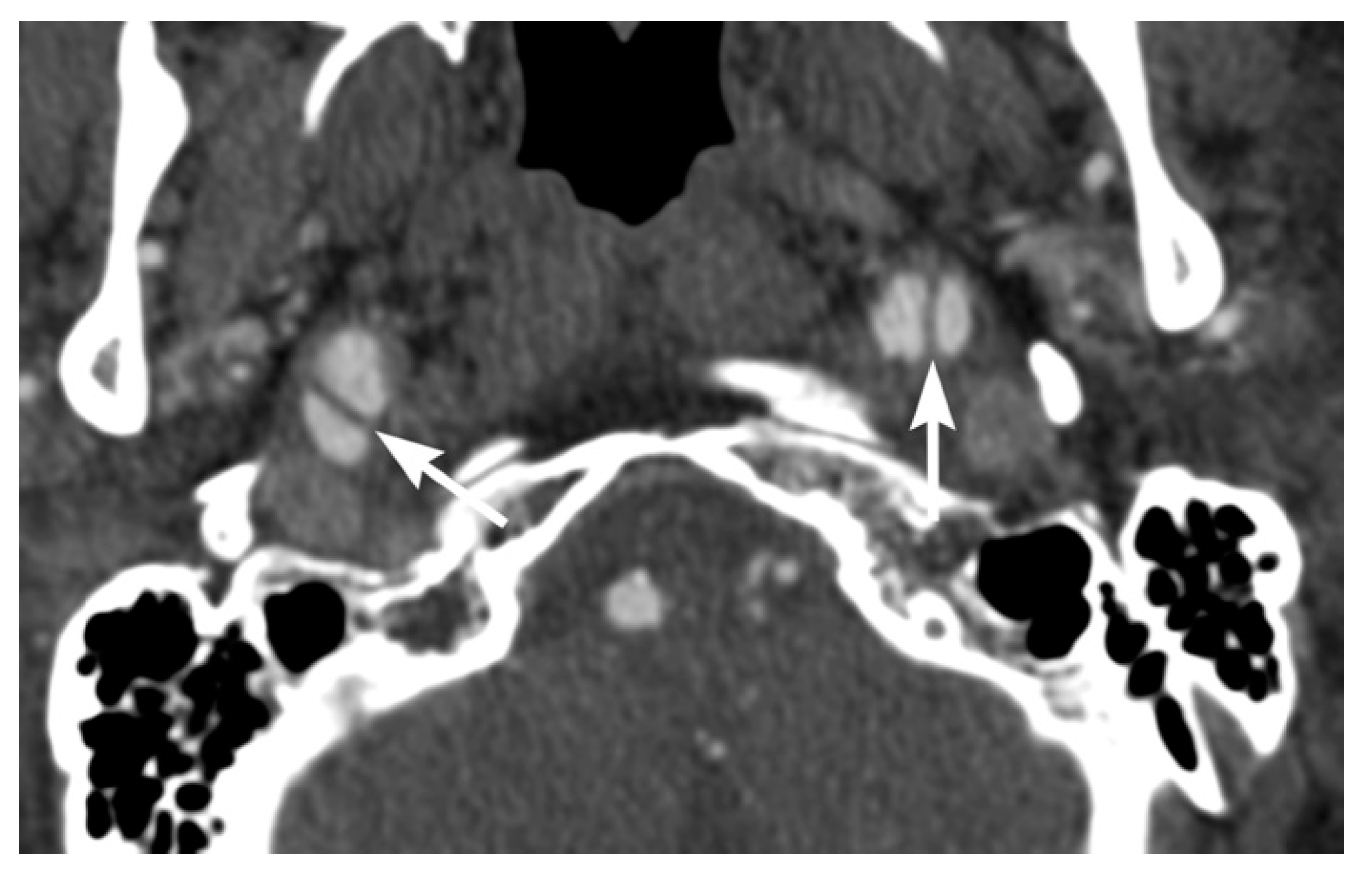 Tomography 08 00033 g005 Tomography 08 00033 g005